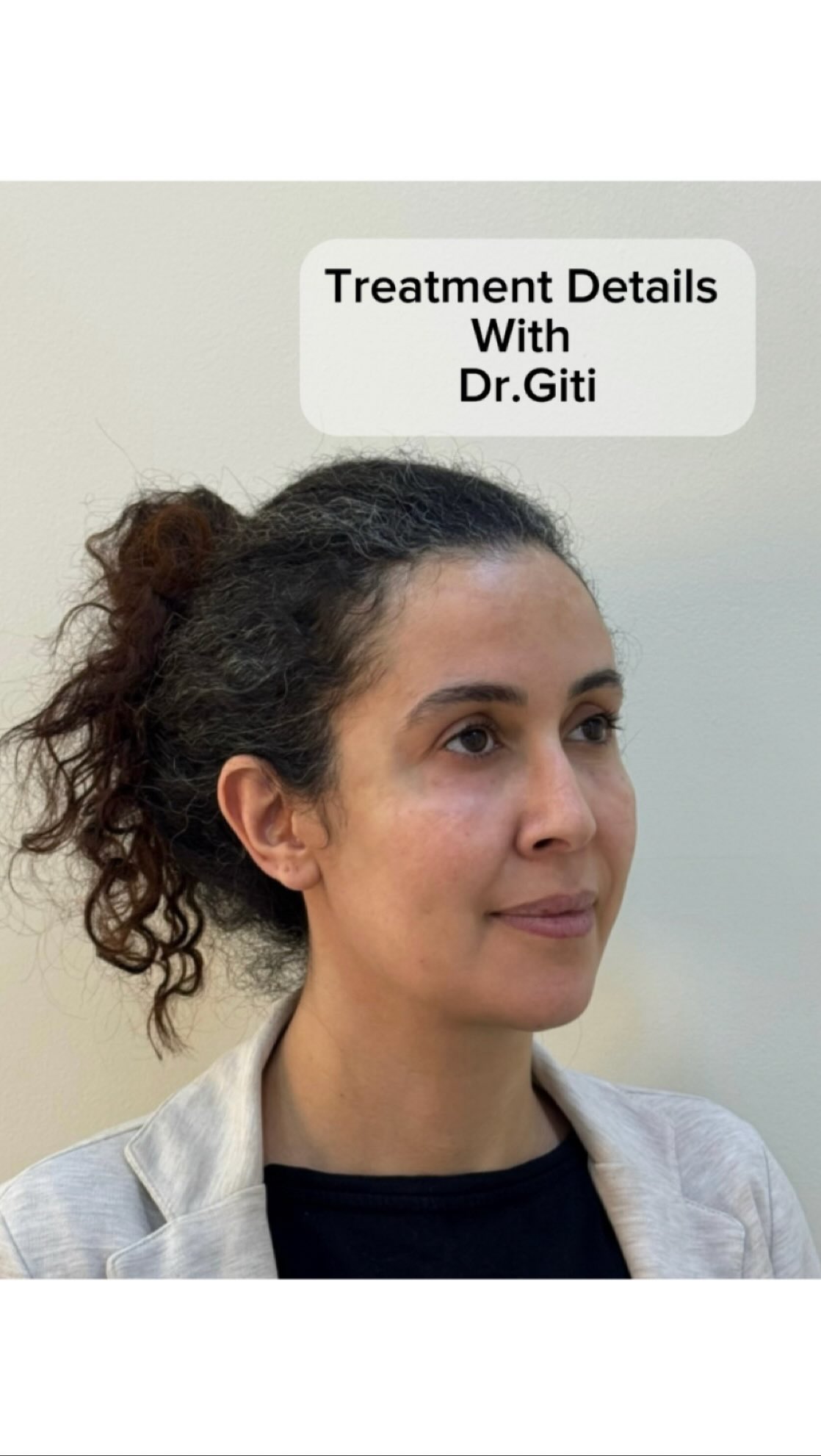 Aging usually is not showing up with one symptom,
Mostly is combination of structural changes over time,
So it should be addressed with same logic 🤌🏼✨
...
The sequence and reason behind each combination , all make a huge difference in your results 👍🏼
.
.
.
#endoliftdubai #endolift #regenerativetreatment #structuraltreatment