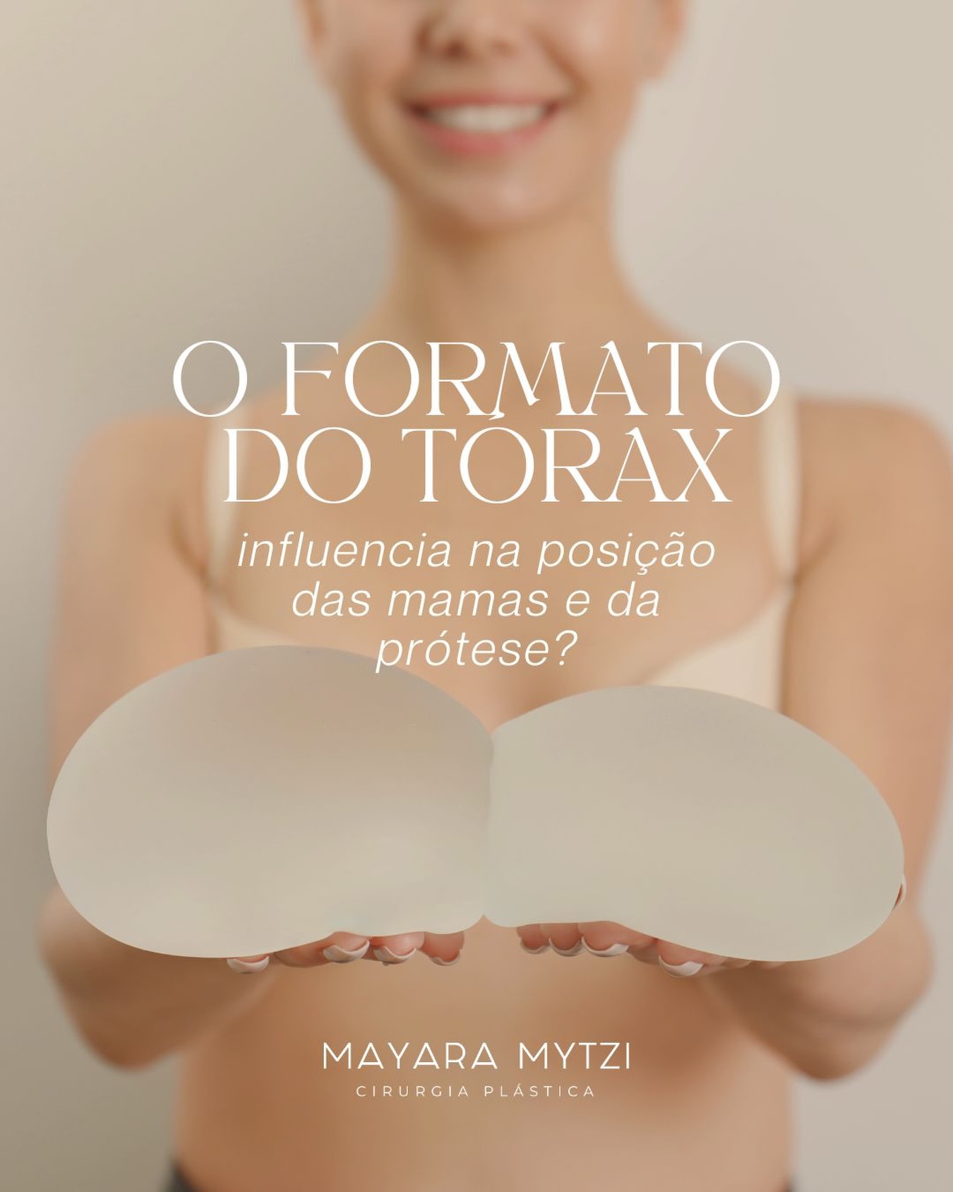 Cada corpo é único, e o formato do tórax influencia diretamente a posição e o resultado das mamas.
Diferenças na largura e no desenho do tórax (como a sua inclinação do centro para a periferia) impactam a distância entre as mamas, a projeção e o equilíbrio do resultado. Um tórax mais estreito pode aproximá-las visualmente, enquanto um mais largo tende a afastá-las.
Além disso, há pacientes com deformidades torácicas, como o pectus excavatum e o pectus carinatum, que tornam a cirurgia ainda mais complexa.
Por isso, o planejamento cirúrgico deve ser individualizado, respeitando sua anatomia, sua saúde e seus objetivos.
Com uma boa avaliação, é possível alcançar resultados naturais, harmônicos e seguros.
Dra. Mayara Mytzi
CRM SP 136.044 • Médica
Cirurgiã Plástica • RQE 66881
#dramayaramytzi
#cirurgiaplastica