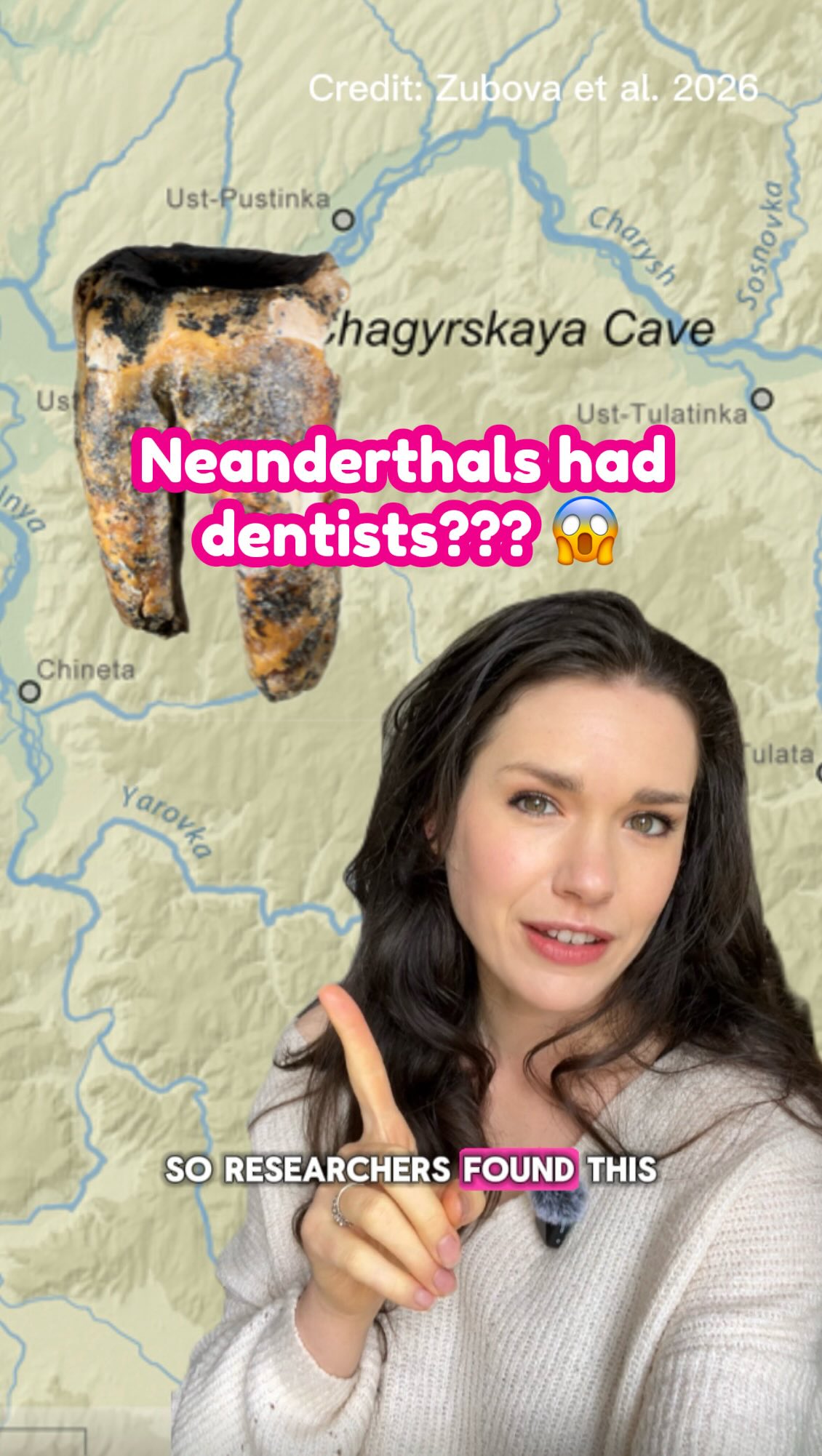 59,000 years ago, it looks like Neanderthals were practicing a primitive form of dentistry - thatās 45,000 years earlier than the oldest evidence we have of human dentistry.
Not only do they seem to have removed decaying parts of a tooth but the patient seems to have survived the procedure and continued to eat relatively normally!
By studying the grooves on the tooth, Alisa Zubova and colleagues found that the markings around the hole appear to have been made using a small pointed stone - in other words, a primitive dentist drill!!
This finding adds to a growing body of evidence that Neanderthals were much more like us than we once thought. Having said that, can you IMAGINE having your tooth drilled without any anaesthetic š³
#neanderthals #humanhistory #dentistry #sciencenews #humanevolution