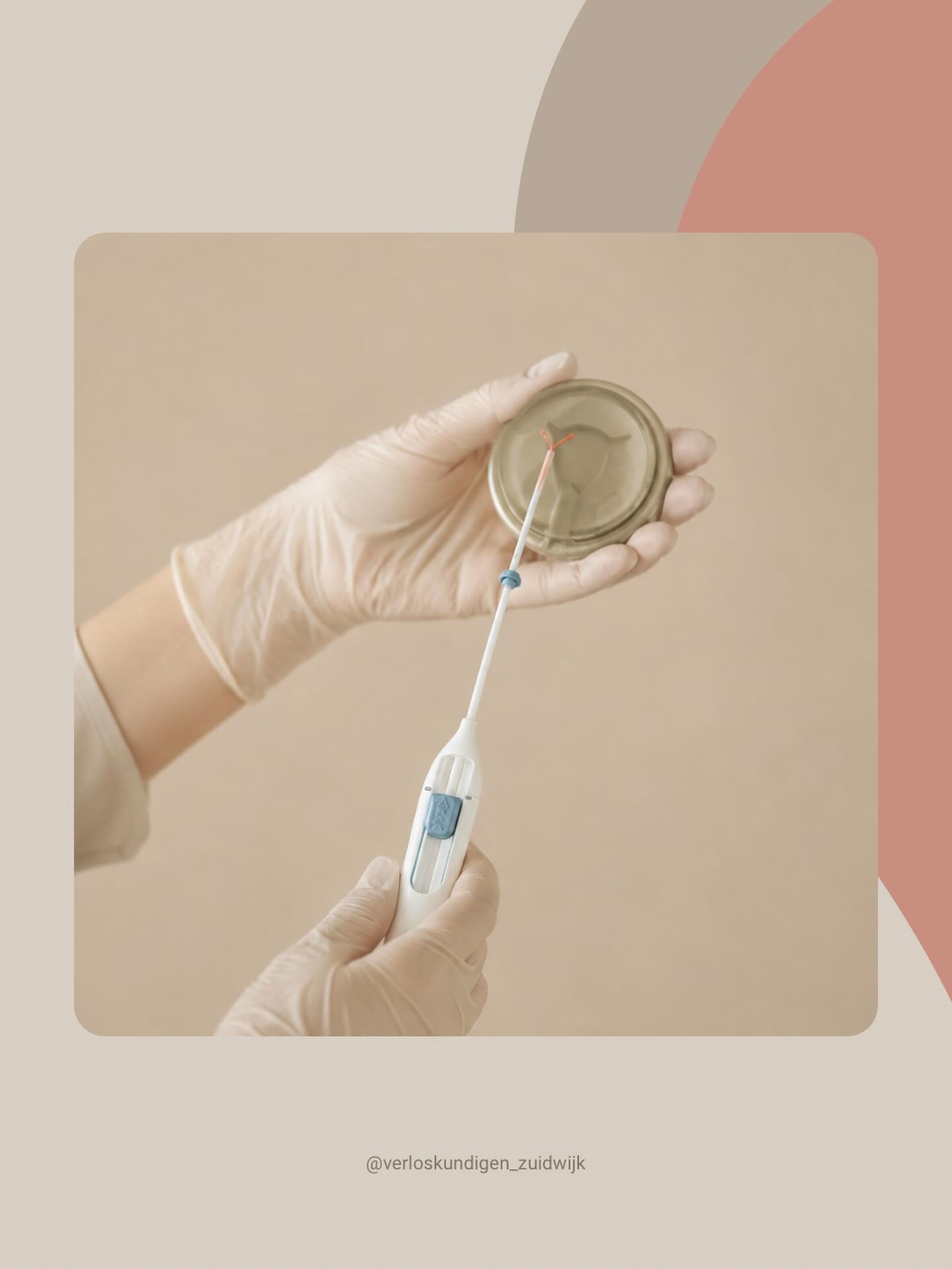 ANTICONCEPTIE ✨
Je bent bij onze praktijk niet alleen welkom tijdens je kinderwens, zwangerschap of kraambed. Ook voor anticonceptie kun je bij ons terecht. Binnen onze praktijk hebben we verloskundigen die gespecialiseerd zijn in het plaatsen van:
• Koperspiraal
• Hormoonspiraal
• Implanon
Samen kijken we naar een anticonceptiemethode die bij jóu en jouw situatie past! Heb je vragen of wil je een afspraak maken? Neem gerust contact met ons op 🤗