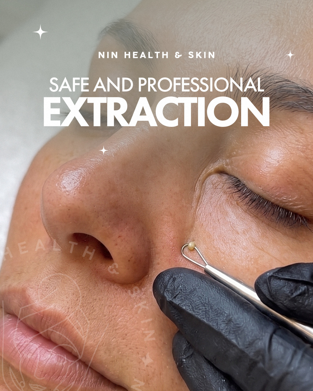 Reveal cleaner, healthier skin with expert care.
Your glow starts here 💆♀️✨
#Skincare #FacialTreatment #DeepCleansing #HealthySkin #GlowUp