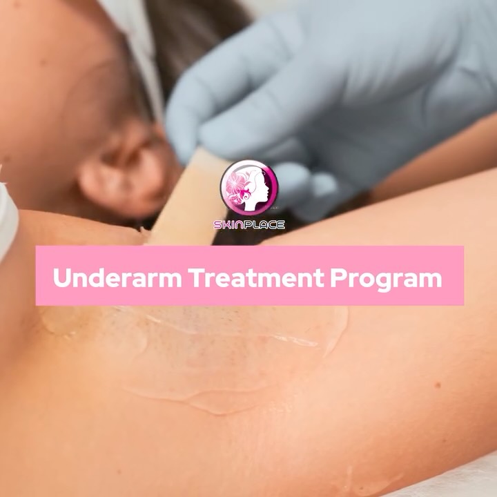 Get the confidence to raise your hands! 🙌✨
Our Underarm Treatment Program is designed to give you the smooth, bright, and clean skin you’ve always wanted. Here’s how:
🪒 Hair Removal: For long-lasting, stubble-free smoothness.
🧬 Skin Rejuvenation: Restores texture and reduces roughness.
🖤 Carbon Peel: The ultimate deep clean to brighten and even out skin tone.
Ready to start your journey? 💖
📍 Skin Place: Your Skin’s Place.
✨ See comment section for more details! ✨
#SkinPlace #UnderarmCare #CarbonPeel #SmoothSkin #SelfCarePH #UnderarmWhitening