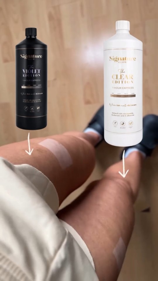 3h Rinse time vs pale skin (48h after tan)
Over the years I’ve tested spray tan solutions from all around the world: UK, Australia, Canada and the US. Testing different formulas is honestly one of the best ways to keep learning and improving as a spray tan artist
When I test a solution, I pay attention to every detail. ➡️ Does the solution dry the skin and which ingredients may affect that?
➡️ Does it leave the skin hydrated and moisturised?
➡️ How does it react with leftover deodorant, skincare or sweat?
➡️ What does the final colour look like once fully developed? Does it pull yellow/orange or stay beautifully natural?
One thing I always pay attention to when testing spray tan solutions is whether the label claims are actually true… or just marketing
This is exactly why I love trying different solutions every single one teaches me something new about skin chemistry, ingredients and final results 🤎
Recently I’ve been testing the Signature Glow Rapid Rinse solutions: Violet Base and Clear Spray Tan Solution. Both are fragrance free and have a short, moisturising ingredient list, which I know many clients will appreciate, especially those with sensitive skin.
Very soon I’ll also be adding a clear, fragrance free solution to my menu for clients with sensitive skin or allergy tendencies 💪
#clearspraytansolution #fragnancefreespraytansolution #spraytanleicester