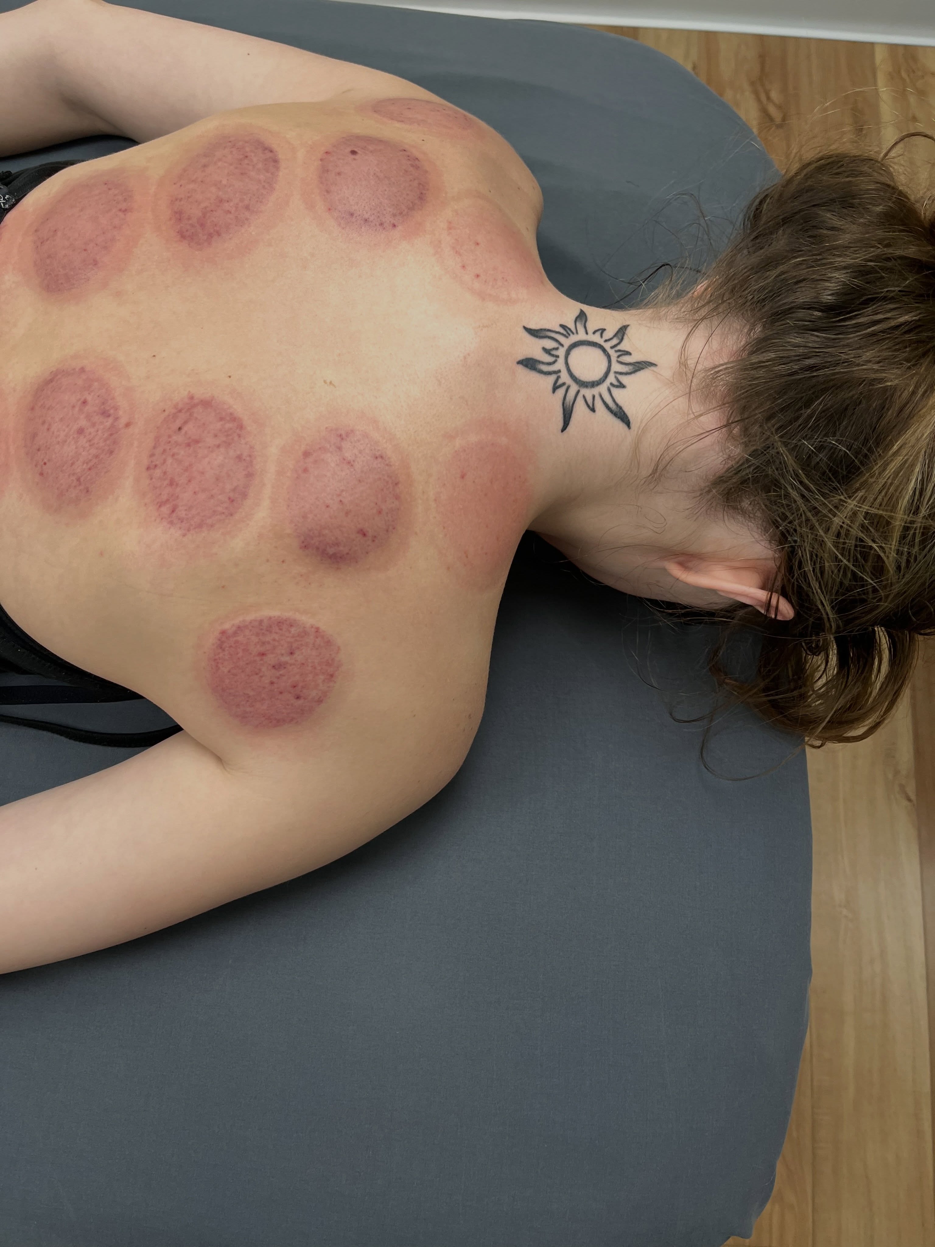 Cupping therapy works by creating gentle suction on the skin to help increase circulation, release muscle tension, and support lymphatic drainage. The circular marks left behind are NOT bruises caused by trauma — they’re temporary discoloration from stagnant blood and fluids being brought to the surface.
Many clients use cupping to help with:
✨ Muscle tightness & soreness
✨ Neck, shoulder & back tension
✨ Recovery after workouts
✨ Stress relief & relaxation
✨ Improved circulation
The darker the marks, the more congestion may be present in the tissue. Most marks fade within a few days to two weeks.
As always, treatments should be tailored to your body and wellness goals. 💆♀️
📍Beauty Queens Aesthetics & Wellness Medicine
1776 Princess Anne Rd
Virginia Beach, VA 23456
☎️ 757-876-9136
🌐 www.beautyqueensvb.com
.
.
.
.
#CuppingTherapy #therapeuticmassage #painrelieftherapy #vbmoms #pungova
MuscleRecovery MassageTherapy PainRelief LymphaticDrainage Recovery BodyWork StressRelief Circulation WellnessJourney AlternativeMedicine HealthyLifestyle VirginiaBeach VBWellness MedSpa SpaLife BeautyQueens