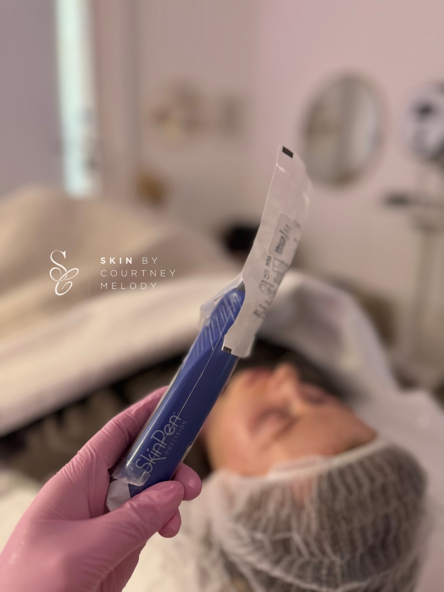 SkinPen Client Cam 📸
Why do I choose to use SkinPen in clinic, and why do my clients respond so well to it?
Because it’s not just “microneedling” … it’s a precision engineered device with safety and consistency at the centre of its design.
SkinPen is the first FDA cleared microneedling device, developed to deliver controlled collagen induction therapy with a high level of reproducibility across treatments.
What makes SkinPen clinically different is the engineering behind it:
➡️ Sterile, single-use 14 stainless steel Japanese needle cartridges to maintain infection control standards with a special locking mechanism avoiding any risk of cross contamination VIA black flow through the pen
➡️ Consistent vertical needle stamping (rather than dragging or scratching trauma)
➡️ Adjustable depth settings for different anatomical areas and skin indications
➡️ A motor system designed to minimise lateral skin damage and reduce unnecessary tearing
➡️ Built-in safety protocols to support controlled, repeatable treatment outcomes
SkinPen creates thousands of precise microchannels in the epidermis and dermis. These controlled injuries activate the skin’s wound healing response:
1️⃣ Inflammation phase
Vascular response increases, immune cells activate, and signalling molecules are released.
2️⃣ Proliferation phase
Fibroblasts are stimulated, increasing synthesis of collagen, elastin and extracellular matrix components.
3️⃣ Remodelling phase
New collagen fibres reorganise and mature over time, improving structural integrity and skin quality.
Concerns I use SkinPen to treat:
✒️ Acne scarring
✒️ Fine lines + wrinkles
✒️ Skin texture irregularities
✒️ Enlarged pores
✒️ Pigmentation unevenness
✒️ Overall dermal strength and quality
& you get an aftercare kit to take home with you for optimal skin healing 💙