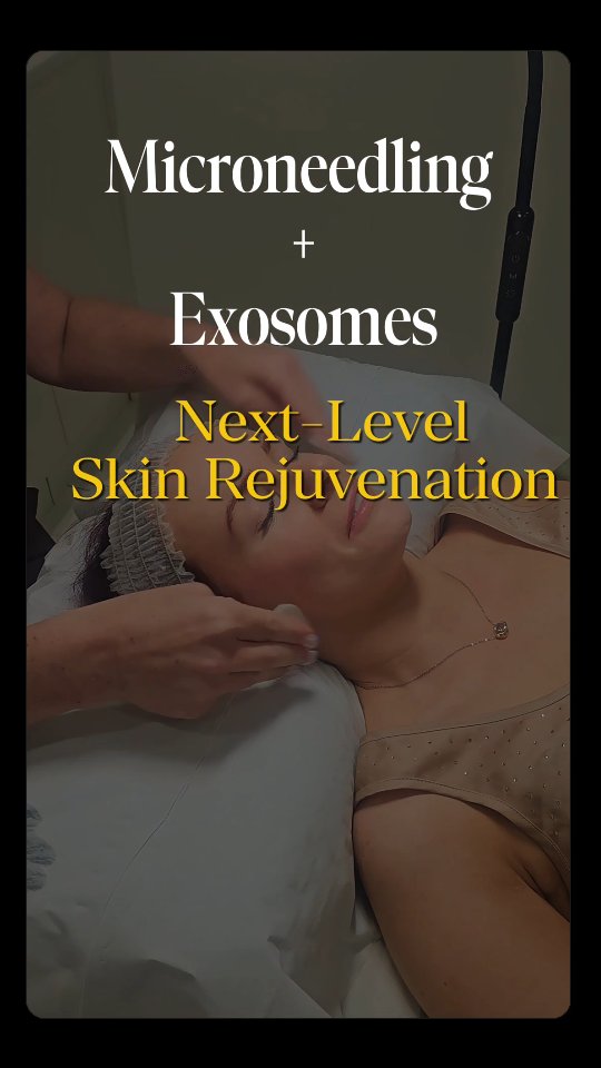 Healthy skin starts beneath the surface
Microneedling with Exosomes is designed to support your skin’s natural regeneration process by delivering advanced growth factors that help repair, hydrate and rejuvenate the skin from within.
This treatment helps improve overall skin health, texture, hydration and glow while supporting collagen production for a firmer, brighter complexion.
Because great skin isn’t just about makeup… it’s about giving your skin what it needs to function at its best
#essexbeauty #Microneedling#essexskin #essexskinclinic #essexmicroneedling #exosome #basildonfacial