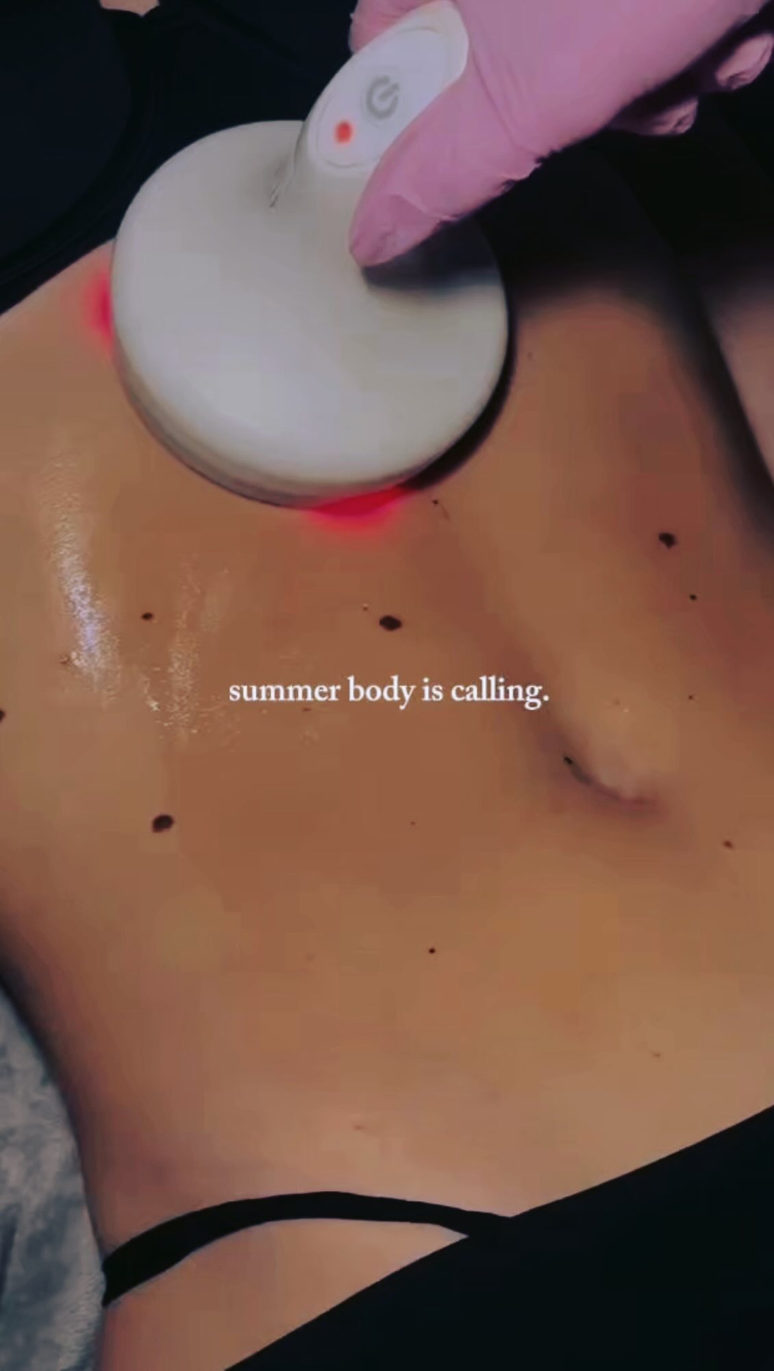 Hot girl summer… but make it IAM. ✨
Body sculpting, skin tightening, lymphatic contouring, and luxe wellness protocols designed to help you feel confident from every angle.
Your summer body? We don’t chase it — we build it. ☀️🤍
#InstituteOfAestheticMedicine #IAMSummerBody #BodyContour #LuxeWellness #BodyGoals SummerReady IAMGlow BodySculpting SkinTightening WellnessAesthetics MiltonDE BerlinMD