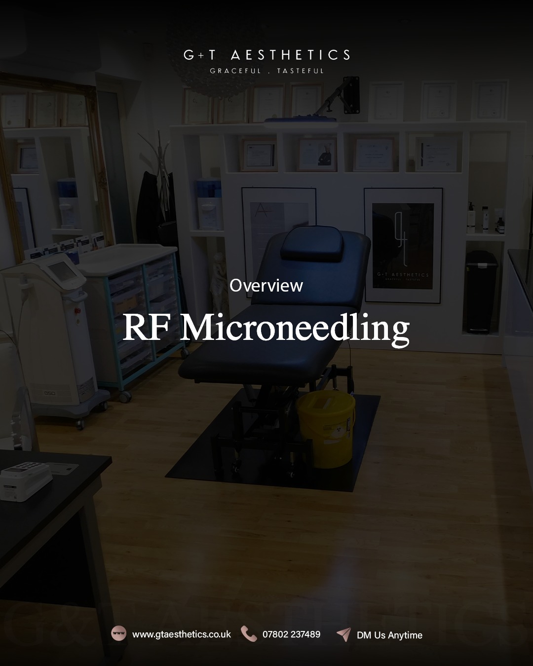 A results-driven treatment designed to improve skin quality and firmness.
Discomfort: Minimal
Session time: 60-90 minutes
Longevity: Up to 12 months
RF microneedling works beneath the surface to stimulate collagen production, supporting long-term skin improvement.
📲Enquire or visit www.gtaesthetics.co.uk for more info.
#RFMicroneedling #SkinTightening #CollagenBoost #AdvancedAesthetics #SkinHealth #GTAesthetics