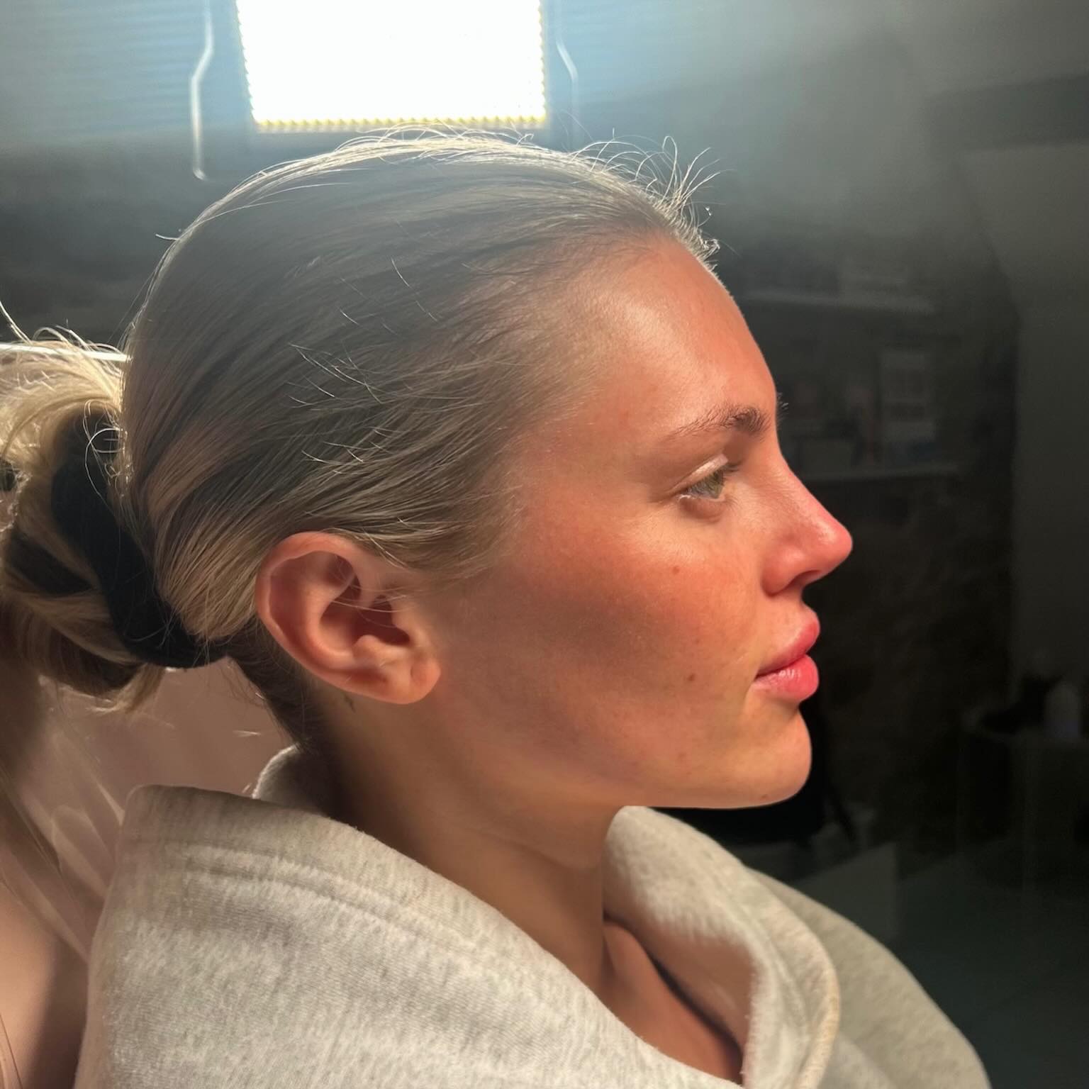 ⠀
Side profile of dreams ☁️😍
__________________________
Get in touch 👇🏽
𝐃𝐌 𝐔𝐒 𝐅𝐎𝐑 𝐄𝐍𝐐𝐔𝐈𝐑𝐈𝐄𝐒
GIFT VOUCHERS AVAILABLE
SWIPE FOR CLINIC DATES
⭐️ 5 STAR GOOGLE REVIEWS
💻 www.archedaesthetics.co.uk
📱 𝗪𝐇𝐀𝐓𝐒𝐀𝐏𝐏 07517416782
📧 hello@archedaesthetics.co.uk