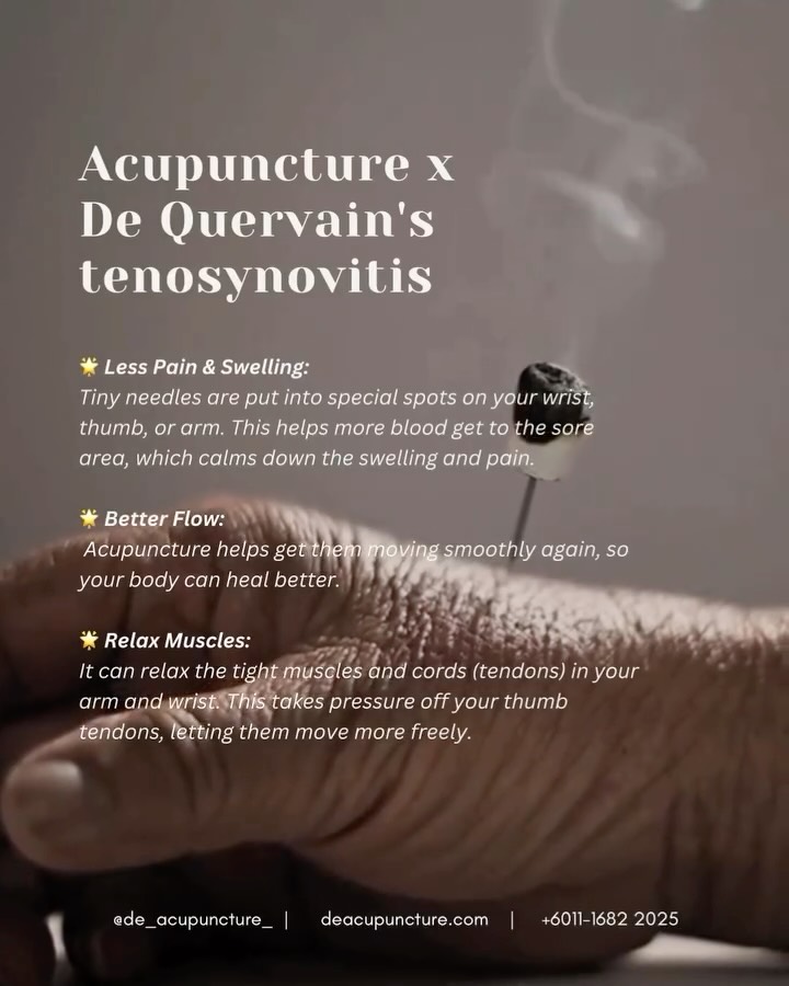 🎯 Stop the “Mommy Wrist” Pain! ✋ Acupuncture for De Quervain’s Tenosynovitis
That sharp pain at the base of your thumb and wrist—often called De Quervain’s Tenosynovitis or “Mommy Wrist”—is due to inflamed tendons.
Resting and splinting can take forever, but Acupuncture offers a powerful, faster solution! 🚀
How Acupuncture Helps:
💛Knocks Out Pain:
We needle local points to directly reduce inflammation and soothe the throbbing pain.
💛Boosts Healing:
Acupuncture resolves Qi and Blood stagnation, bringing vital circulation to the damaged tendon sheath to speed up repair.
💛Restores Function:
By calming the overworked tendons, you regain grip strength and mobility faster.
In TCM, we treat the root cause, not just the pain. Is it Cold-Dampness or an energy deficiency? We tailor the treatment just for you.
Ready for a pain-free grip?
Book your consultation at 医心医意中医坊 De Acupuncture x Herbs Centre today! 💖
#DeQuervains #MommyWrist #Acupuncture #TCMHealing #WristPain #SubangJaya #DeAcupunctureXHerbsCentre