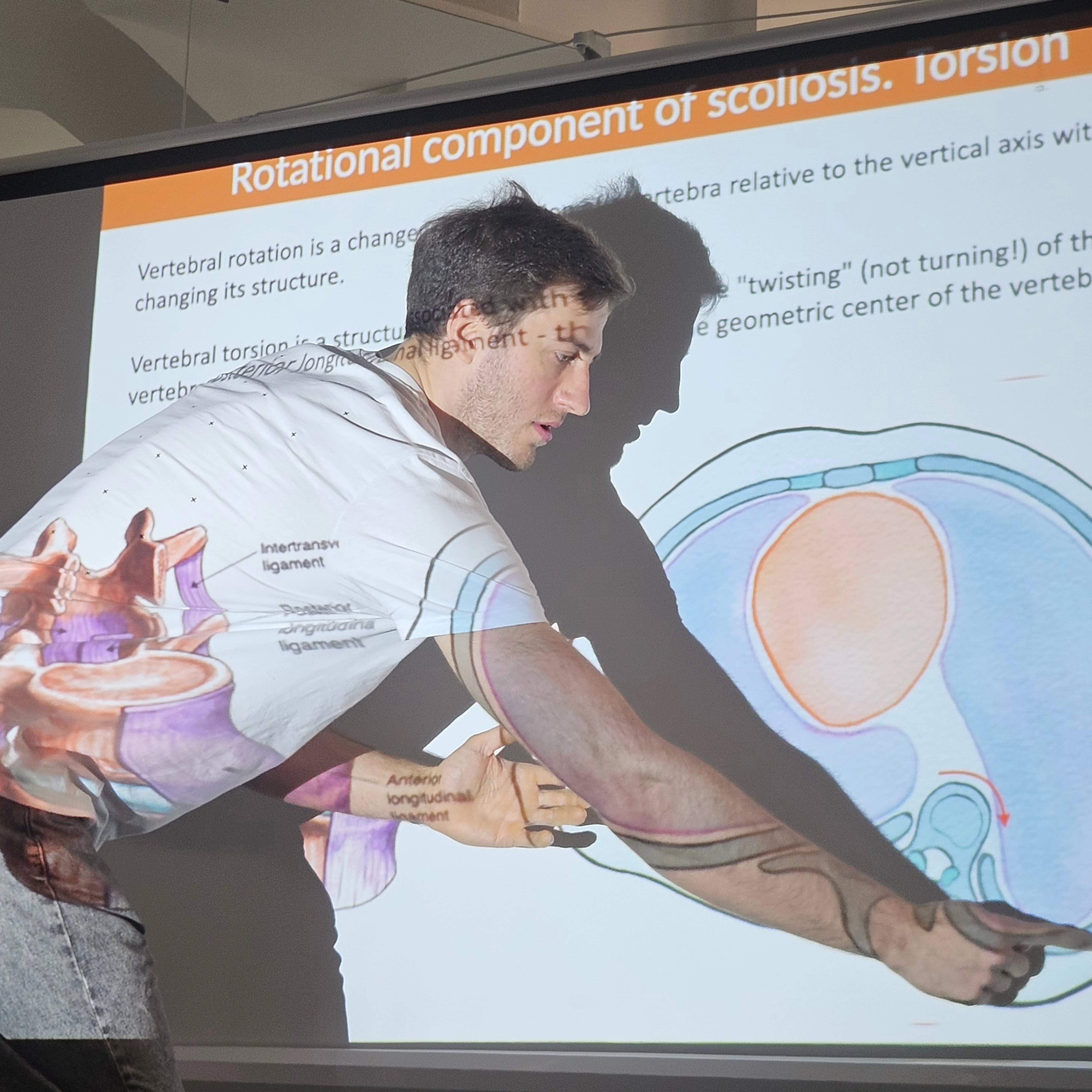 Scoliosis Master Class with Serhii Kozin, PhD
#shroth #sideshift #SEAS #DuboMed
@kozin.serhii.pt @serhii.kozin @chandlerka_ @dr.tino.janikov @michal_jonas @katarina_healthytraining @roots_health_prague
A Big Thank You to our model Sofia!
Learn more about Serhii here:
https://www.advancetraining.cz/team/serhii-kozin