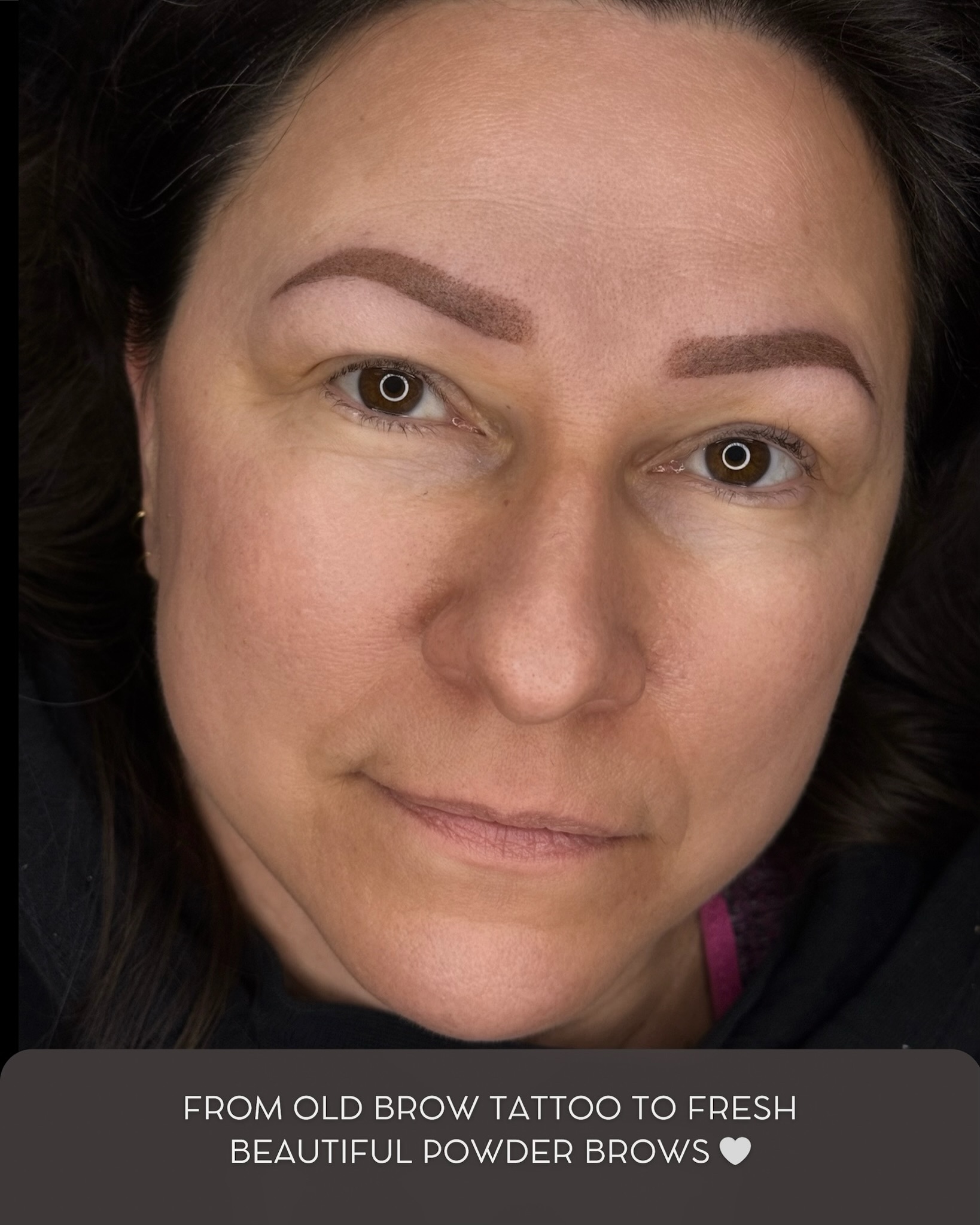 Behind every beautiful transformation is trust 🤍
Not every brow correction is easy.
Sometimes it takes laser removal, color correction, patience and a completely new approach to finally achieve soft, natural-looking brows that truly fit the face.
And moments like this, when clients look in the mirror with happy tears in their eyes, remind me why I love what I do so much ✨
Permanent Makeup Services,
Tattoo Removal & Carbon Laser Facial
⬆️Book apt with the link in bio
✨Free Consultation available
📍Oshawa, Ontario
✉️browsbyieva@gmail.com
☎️416-804-6749
Website:
permanentbeautybyieva.com
#powderbrows #ombrebrowsoshawa #oshawa #downtownwhitby #whitbyontario