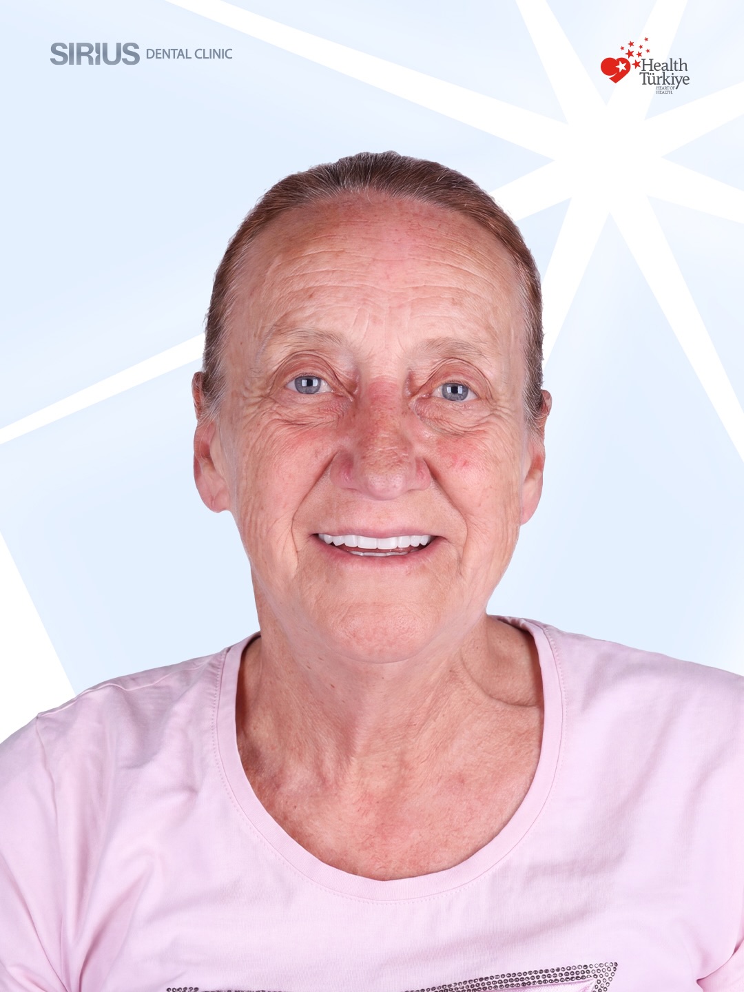 Our lovely patient, Maike Johanne Wilken Alberts, came to us with missing teeth and difficulty chewing. We placed 10 implants and fitted her temporary teeth on the very same day.
After 3 months, she returned and within just 5 days, her permanent teeth were ready. Now she’s leaving with a confident, happy smile.
