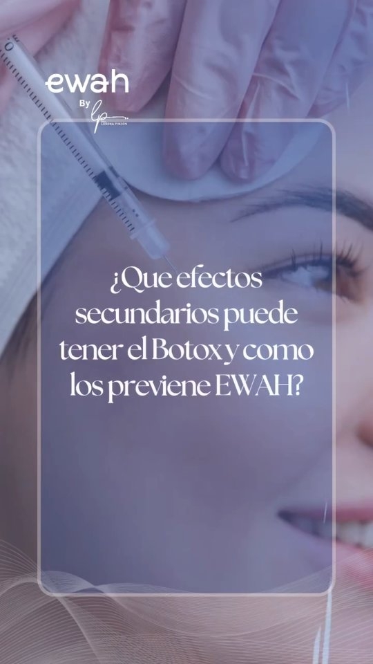 Que efectos secundarios puede tener el Botox y como los previene EWAH?
El Botox es extremadamente seguro cuando es aplicado por medicos certificados. Los efectos secundarios mas comunes son leves y transitorios: enrojecimiento en los puntos de inyeccion, leve dolor local y cefalea ocasional. Efectos raros incluyen ptosis palpebral (caida del parpado) si el producto migra, lo cual es evitable con la tecnica correcta. En EWAH prevenimos estos efectos mediante evaluacion medica previa detallada, tecnicas precisas con agujas ultrafinas y controles post-tratamiento a los 15 dias.
#cuidadodelapiel #botox #botoxbogota