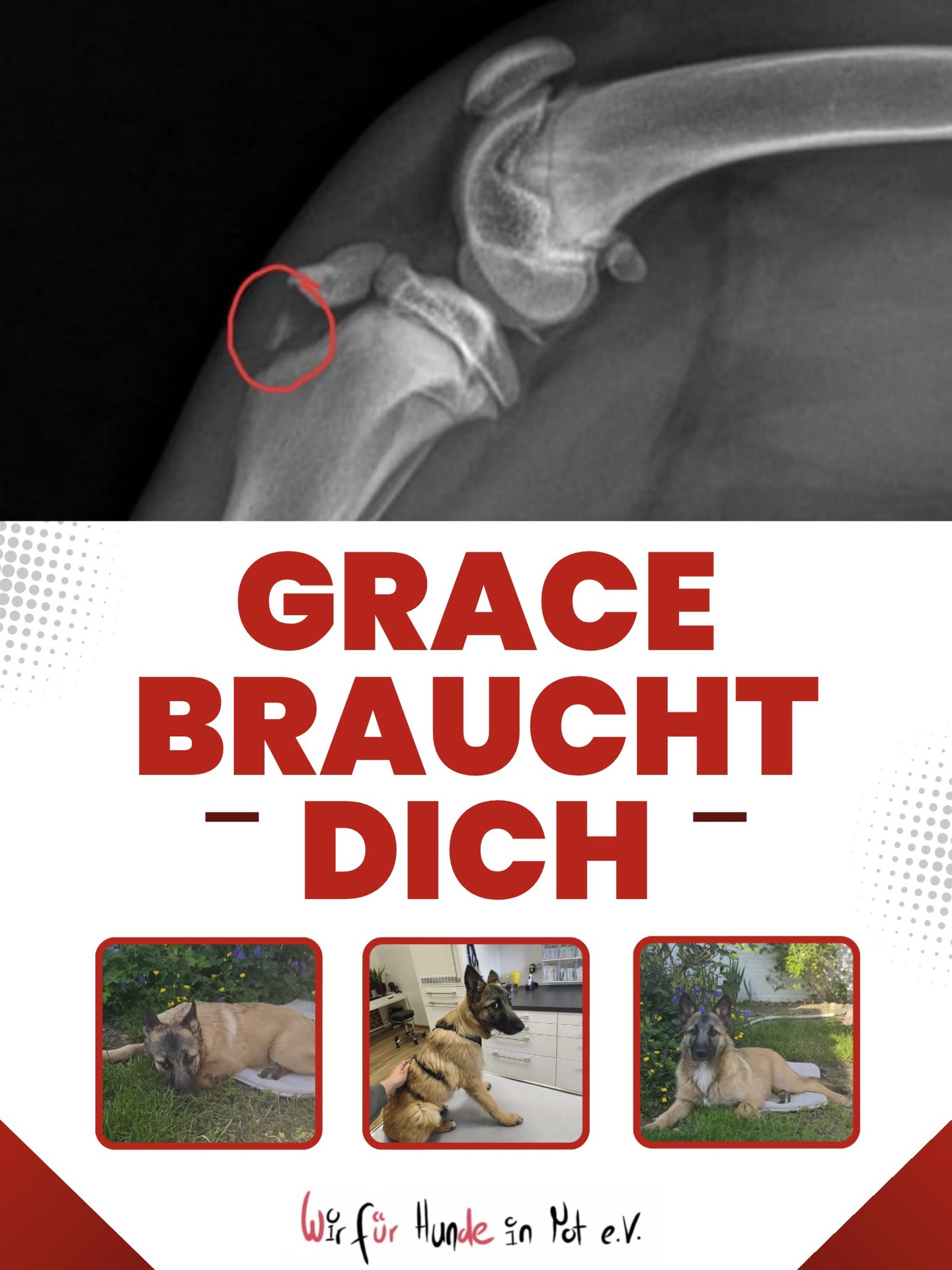 Grace braucht dringend eure Hilfe!
Die kleine Grace ist gerade erst in Deutschland angekommen, als wir feststellen mussten, dass mit ihrem Bein etwas nicht stimmt. Sie humpelt stark und hat große Schmerzen.
Eine Untersuchung beim Tierarzt brachte nun die traurige Diagnose: Grace hat eine Knochensplitterung im Kniegelenk und muss operiert werden. Die Kosten für die dringend notwendige Operation liegen bei mindestens 1.500 Euro, eine Summe, die uns vor große Herausforderungen stellt.
Eigentlich sollte für Grace jetzt ein neues, glückliches Leben beginnen. Stattdessen kämpft sie bereits um die Chance auf ein schmerzfreies Leben.
Deshalb brauchen wir dringend eure Hilfe, damit wir Grace die notwendige Behandlung ermöglichen können. Jede noch so kleine Spende hilft und bringt sie ihrem Weg in eine bessere Zukunft ein Stück näher.
❤️ ( Links in unserer Bio) ❤️
💟 GofundMe: https://www.gofundme.com/f/grace-braucht-eure-hilfe-fur-eine-dringend-benotigte-op/cl/s?utm_campaign=fp_sharesheet&utm_content=amp20_t1&utm_medium=customer&utm_source=copy_link&lang=de_DE&attribution_id=sl%3A33bb7155-f0ff-4377-a0f7-9c515522ce90&ts=1779737221
💟 PayPal (Freunde & Familie auswählen bitte):
spenden@wir-fuer-hunde-in-not.de
💟 Spendenkonto:
Wir für Hunde in Not e.V.
IBAN: DE50 4765 0130 0006 0529 14
Grace & auch wir sind auf eure Unterstützung angewiesen 🙏🏼Danke! 🩷
