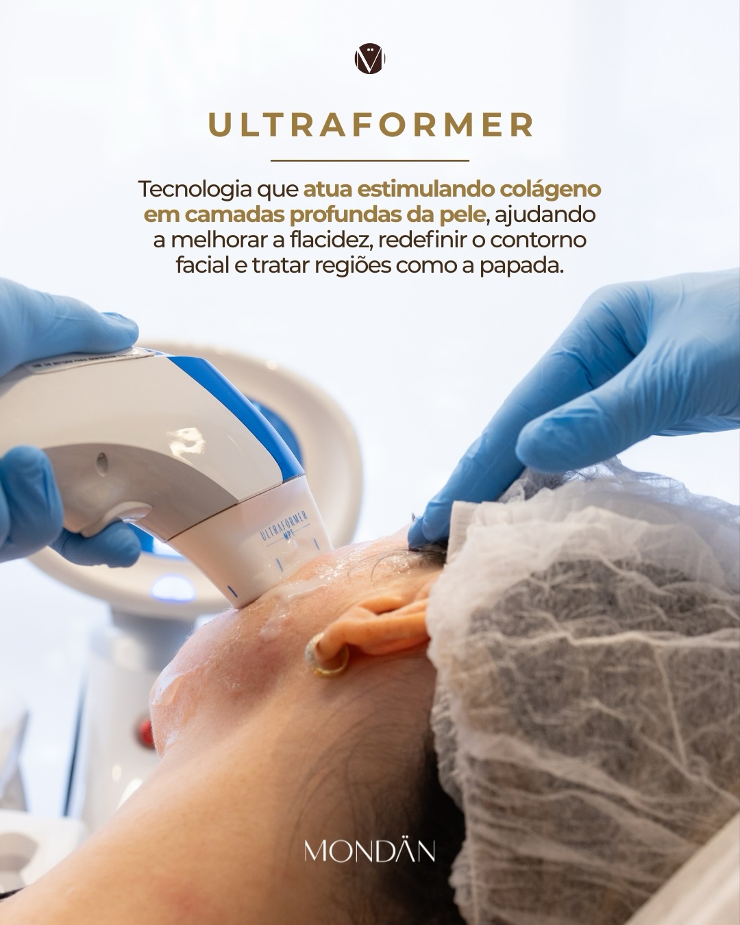 Flacidez, perda de contorno facial e papada são sinais que costumam surgir com a redução de colágeno ao longo do tempo.
Tecnologias como o Ultraformer atuam estimulando colágeno em camadas profundas da pele, promovendo mais firmeza e definição facial de forma gradual e natural.
Na Mondän, cada indicação é feita de forma individualizada, respeitando as características e objetivos de cada paciente.
Agende sua avaliação e entenda o que faz sentido para o seu caso.