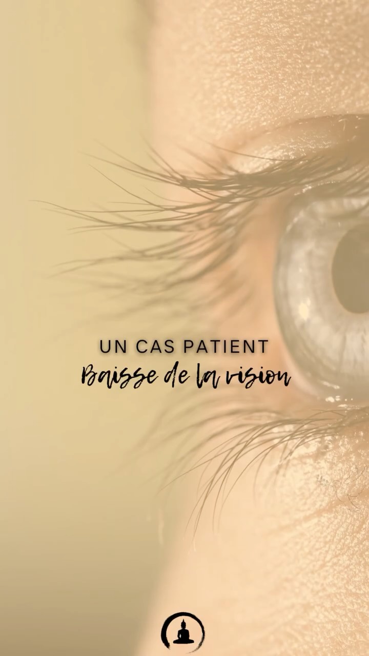 “Quand le corps est en surcharge chronique…
les symptômes ne sont pas toujours là par hasard.”
Baisse de la vision.
Fatigue profonde.
Sensation de brouillard.
Tensions internes.
En médecine chinoise, on ne regarde pas uniquement l’œil.
On regarde :
* la circulation du Qi,
* l’état du système nerveux,
* le Foie,
* les Reins,
* la montée du Yang,
* l’épuisement du corps après une longue maladie.
Parfois, le problème n’est pas “l’œil”.
Le problème est que le système n’arrive plus à récupérer, réguler et nourrir correctement.
Le corps parle.
Encore faut-il apprendre à lire son langage.
📍 Genève
Zen Garden – Serge Romanato
Acupuncture • Fascia • MTC
#medecinechinoise #acupuncture #covidlong #fatiguechronique #systemenerveux #sante #fascia #mtc #geneve #therapiechinoise #bienetre #stresschronique
