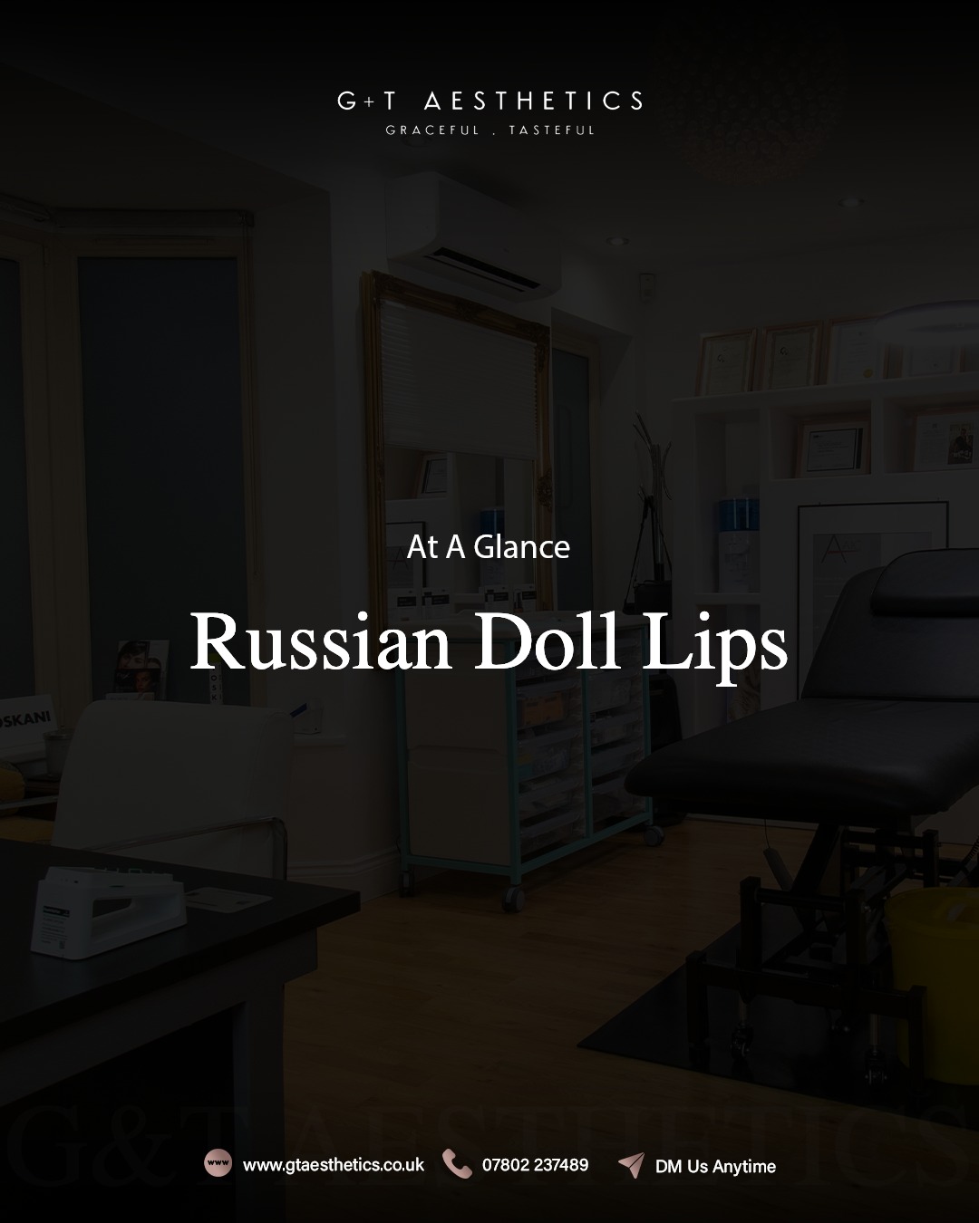 Defined shape with a soft, elevated finish.
Discomfort: Minimal
Session time: 30-45 minutes
Longevity: 9-24 months
Russian Doll Lips focus on structure and contour while maintaining a refined, balanced appearance.
📲Enquire or visit www.gtaesthetics.co.uk for more info.
#RussianDollLips #LipEnhancement #DermalFillers #LipFillerUK #AestheticClinic #GTAesthetics
