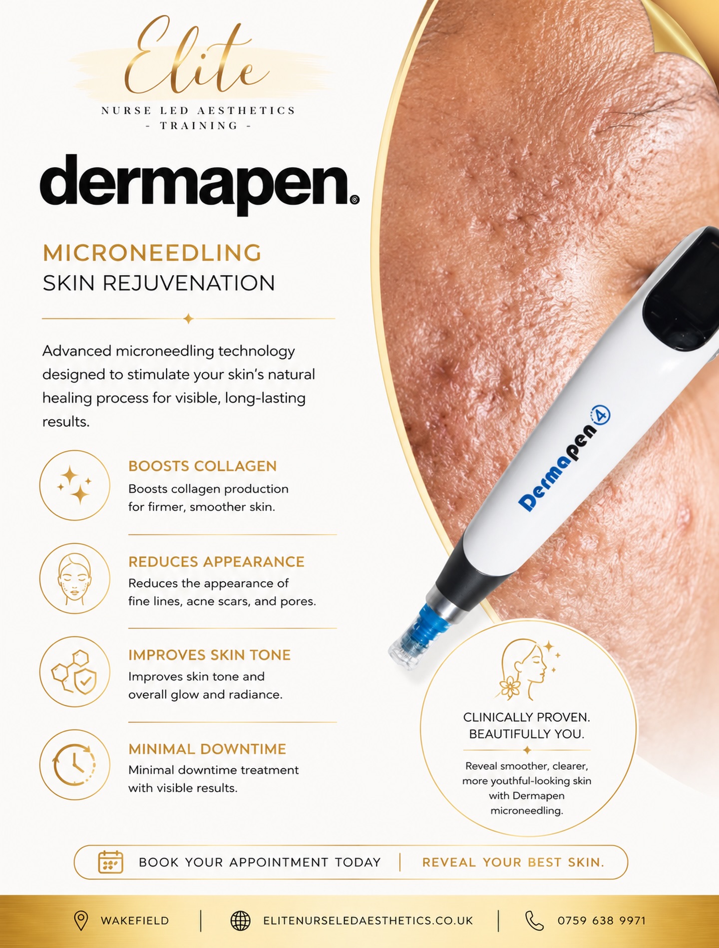 DERMAPEN MICRONEEDLING ✨
Reveal smoother, firmer and more radiant skin with the power of advanced microneedling technology 💫
Dermapen works by stimulating your skin’s natural healing response and boosting collagen production to improve overall skin texture and tone.
💉 Benefits of Dermapen:
• Boosts collagen production
• Helps reduce acne scars & pores
• Smooths fine lines & wrinkles
• Improves skin tone & radiance
• Minimal downtime with visible results
Perfect for those wanting healthier, rejuvenated skin with long-lasting results.
📍 Wakefield
📩 DM Elite Nurse Led Aesthetics to book your consultation today.
#EliteNurseLedAesthetics
#Dermapen
#Microneedling
#WakefieldAesthetics
#SkinRejuvenation