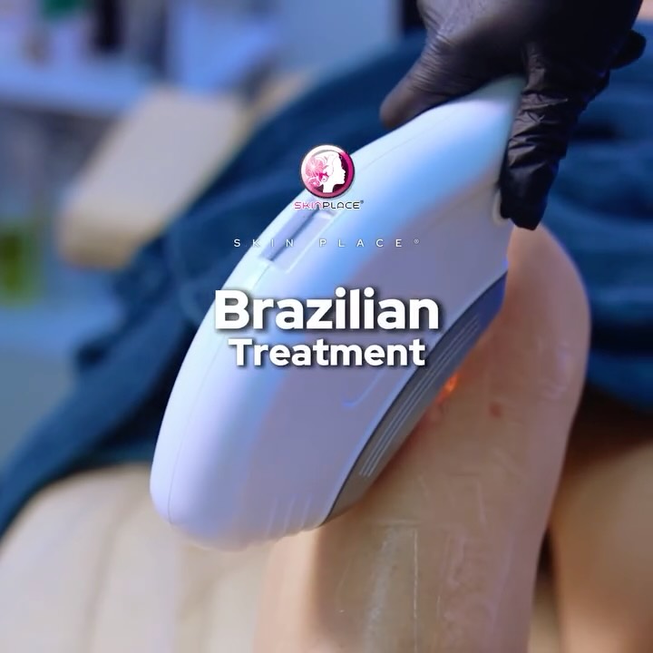 Experience the ultimate fresh feeling. ✨
Our Brazilian Treatment isn't just about hair removal—it’s about skin health and daily comfort. Here’s why it’s a must-have in your self-care routine:
🕊️ Silky Smooth: Leaves skin clean and well-groomed.
⏳ Slow Regrowth: Enjoy that smooth feeling for longer periods.
🚫 No More Irritation: Significantly reduces painful ingrown hairs.
🚿 Total Freshness: Stay comfortable and hygienic all day long.
💖 Pure Confidence: Feel fresh and confident in your own skin!
Ready to experience the Skin Place difference? 💌
📍 Skin Place: Your Skin’s Place.
✨ See comment section for more details! ✨
#SkinPlace #BrazilianTreatment #SkinCare #SelfCareDaily #SmoothSkin #HygieneRoutine