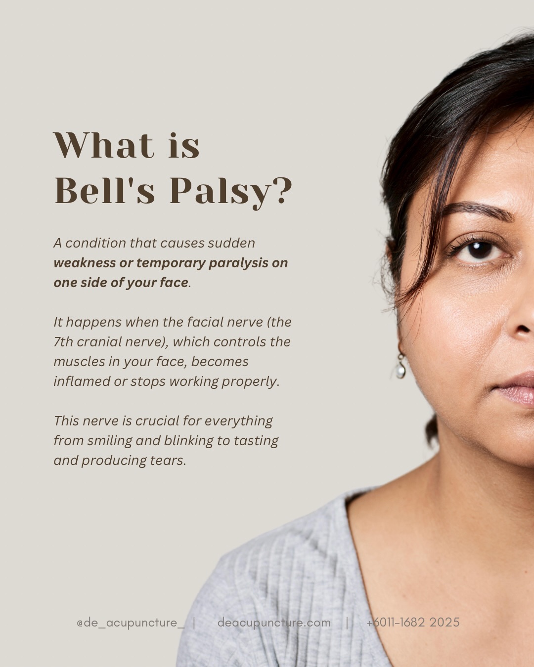Face Drooping? It’s Probably Bell’s Palsy! 😮
Bell’s Palsy is the sudden weakness or paralysis of muscles on one side of your face, caused by inflammation of the Facial Nerve (Cranial Nerve VII).
Symptoms include:
A drooping eyelid and mouth corner.
Difficulty closing one eye, smiling, or controlling facial expressions.
Altered taste or pain behind the ear.
TCM View (The “Wind” Attack):
TCM sees this as Wind (often combined with Cold) invading the facial meridians, blocking the flow of Qi and Blood.
TCM Treatment (Acupuncture is Key):
Acupuncture is widely used to stimulate the nerve, expel the Wind, and restore circulation to the face, speeding up recovery.
⚠️ Urgent Action: Facial drooping can be a sign of a stroke. Always see a doctor immediately to rule out other serious conditions first.
Once diagnosed, let us help! Consult the qualified TCM practitioners at 医心医意中医坊 De Acupuncture x Herbs Centre for a customised plan.
#BellsPalsy #FacialParalysis #Acupuncture #TCM #SubangJaya