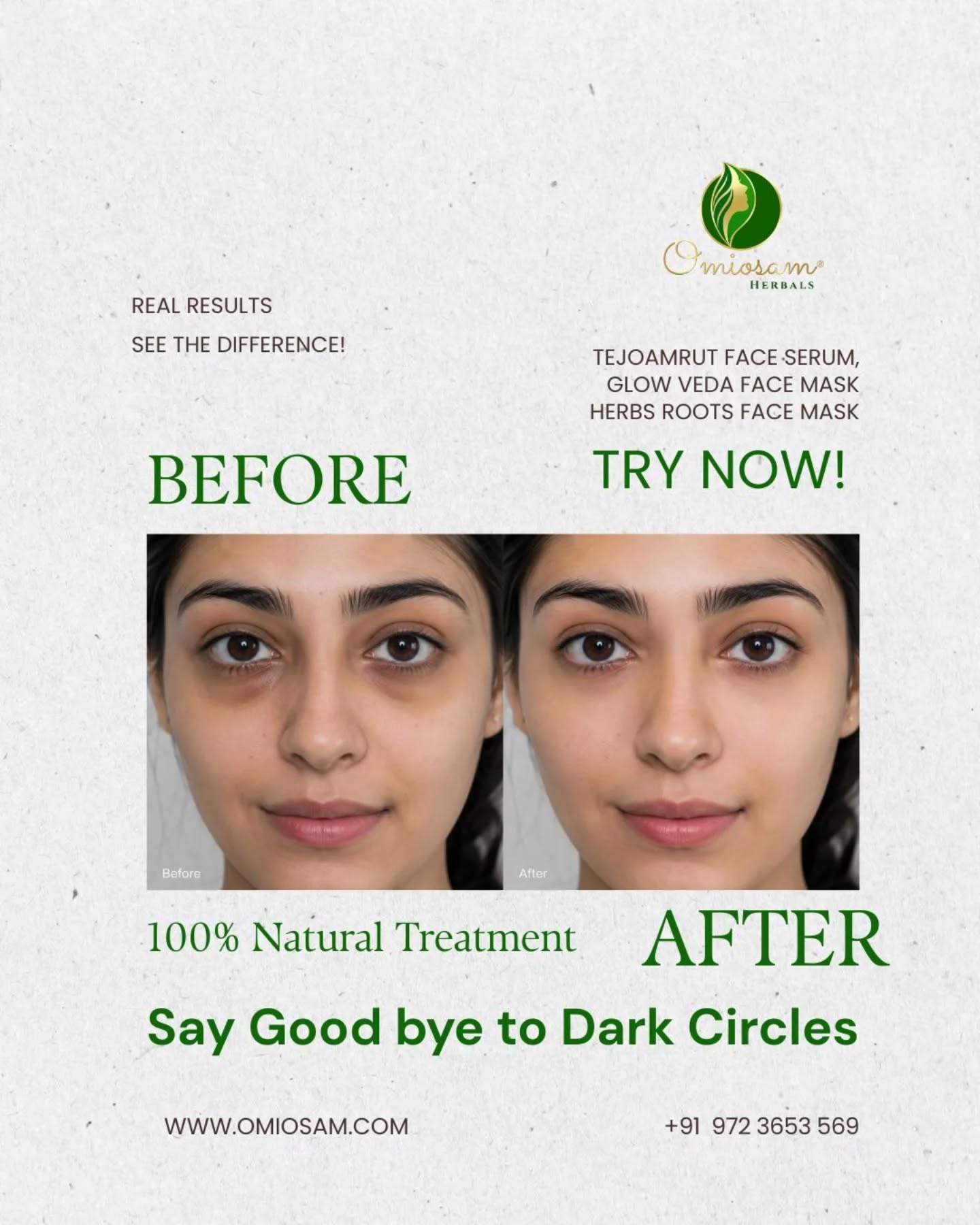 Dark circles don’t disappear overnight — but nature helps heal them gently ✨
Say goodbye to tired eyes with Omiosam’s 100% natural under eye care.
Made with pure ingredients to help reduce under eye circles, puffiness & dullness naturally. 🌿
Wake up looking fresh, brighter & confident every day. 💚
#Omiosam #UnderEyeCare #DarkCircleRemoval #NaturalSkincare #GlowingSkin HealthySkin ChemicalFree SkinCareRoutine NaturalBeauty