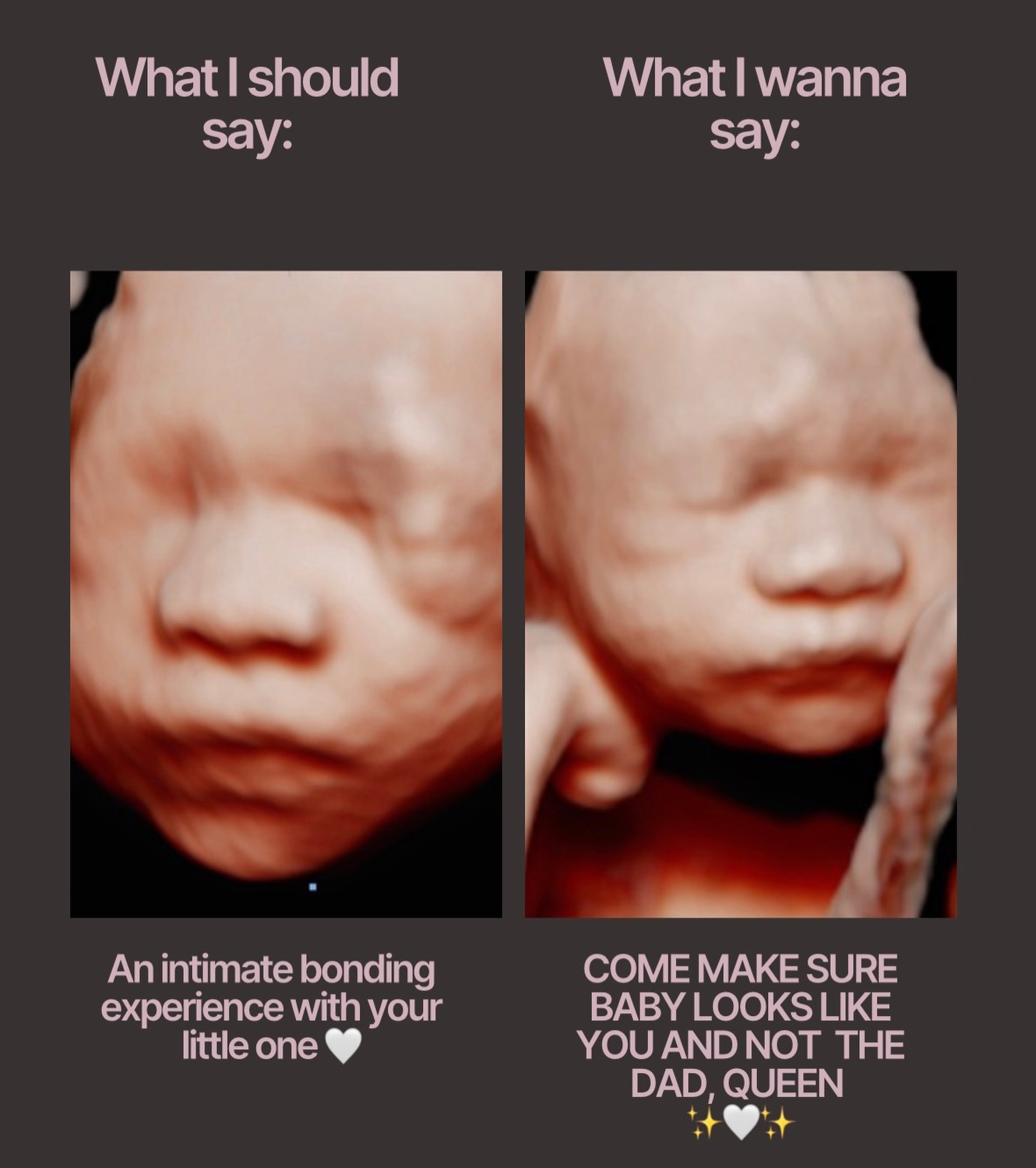 Sometimes I wanna be professional… and sometimes I wanna say what everyone is actually thinking 🤭
because let’s be honest, when we see baby’s face we’re all trying to figure out who’s nose baby has 👀😅