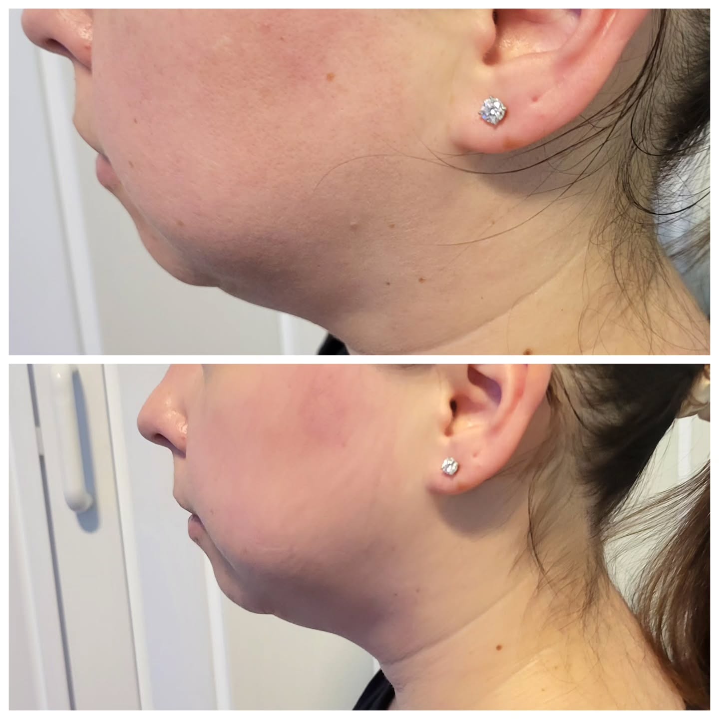@everythingbergen @electrofacelift @skincare @slimcenter.fortlee