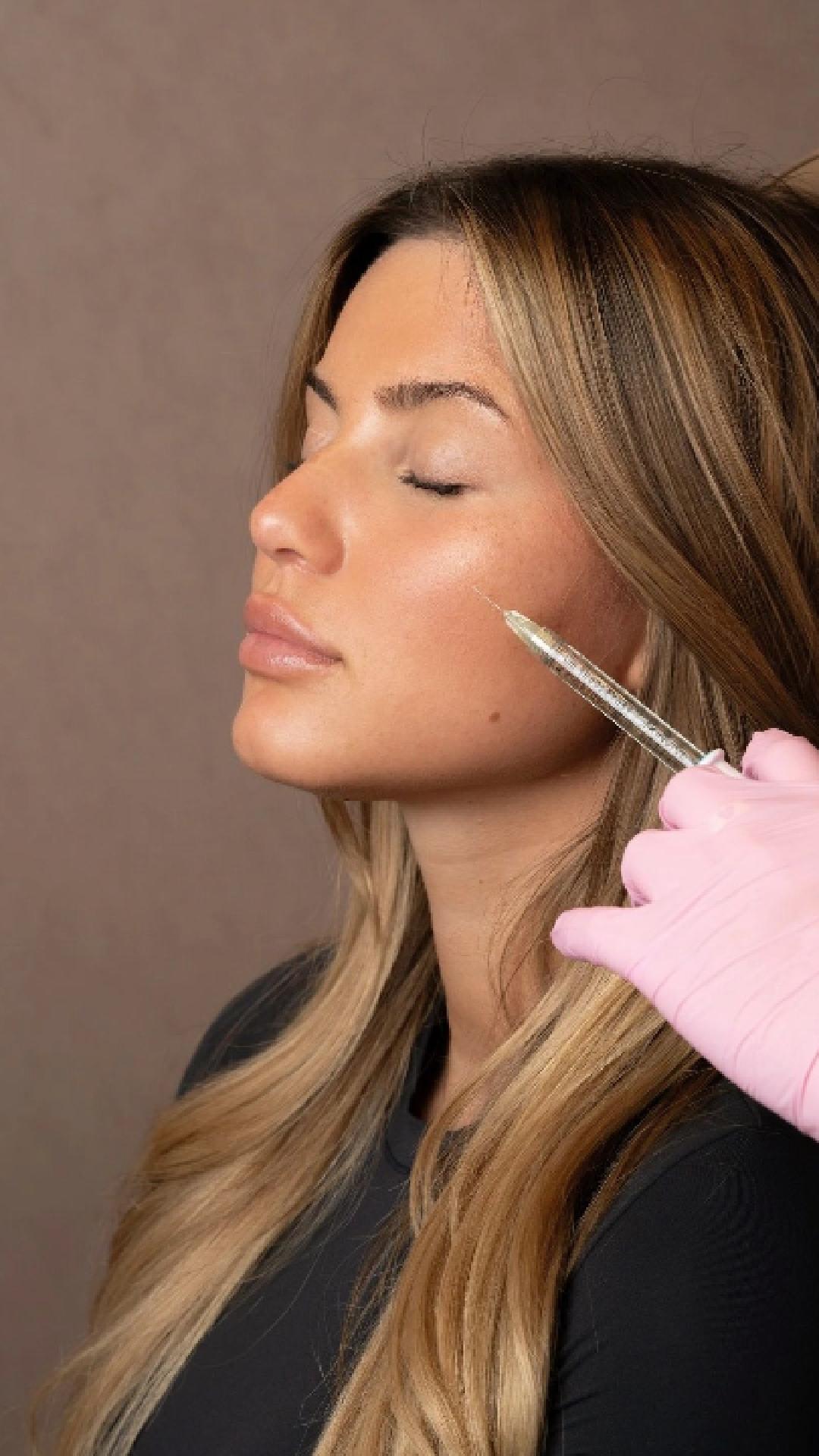 ✨ Restore volume, enhance your profile, and achieve a refreshed appearance with professionally administered cheek filler treatments.
Cheek fillers may help:
✔ Enhance facial contours
✔ Support a more balanced appearance
✔ Improve mid-face volume loss
✔ Create a smoother, lifted look
✔ Provide natural-looking enhancement with minimal downtime
At Medical & Beauty Care Clinic, every treatment begins with a personalized consultation to determine the best approach for your aesthetic goals. Results vary by patient.
📞 224-407-2140
👉 Book today: www.medicalbeautycareclinic.com
🔗 https://linktr.ee/medicalandbeauty
#CheekFiller #AestheticTreatments #MedicalBeautyCare #NonSurgicalAesthetics #BeautyClinic