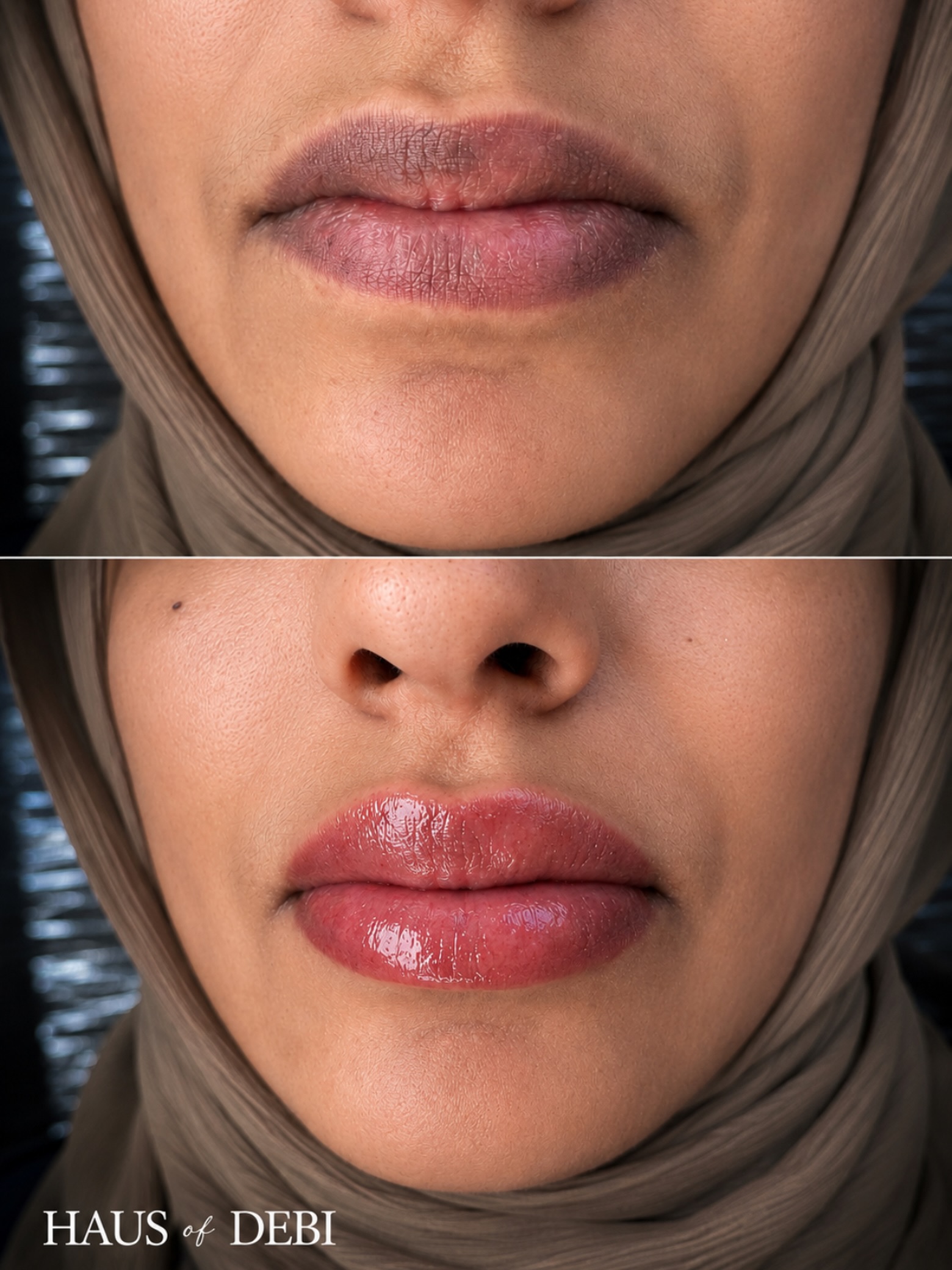 Melanin-rich lips deserve specialized artistry. 🤎
This is called Dark Lip Neutralization, an advanced PMU technique designed to balance cool, dark, or uneven lip tones while keeping the lips soft and natural.
The goal isn’t to erase melanin. It’s to bring warmth, balance, and healthy-looking color back into the lips. ✨
Every set of lips heals differently, and neutralization is a journey, not a one-session transformation. But when done correctly… the results are timeless.
Artist: @dianaisa.ds
#DarkLipNeutralization #MelaninLips #LipNeutralization #LipBlushLasCruces #HausOfDebi