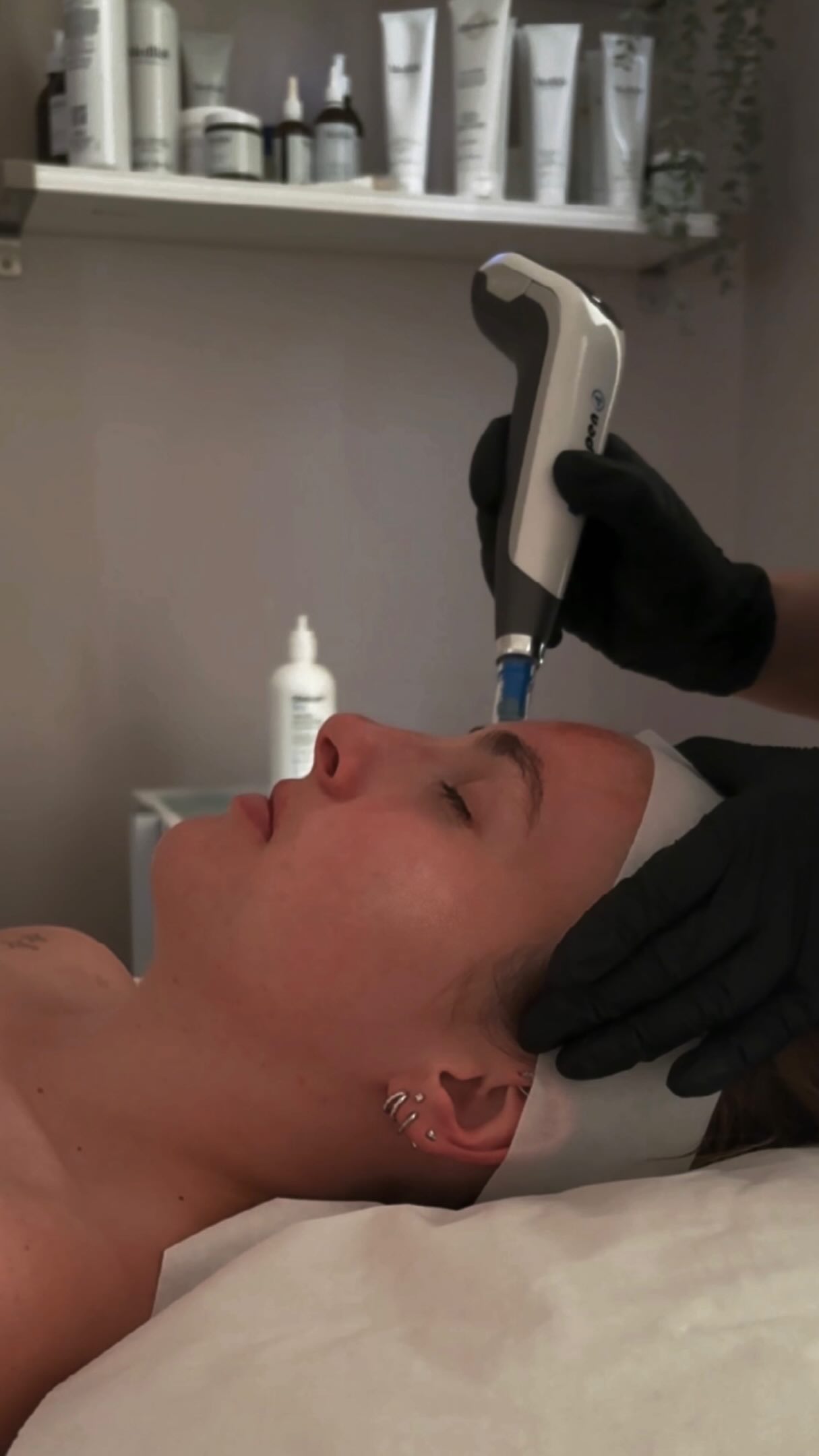 Glass skin isn’t about looking younger. It’s about your skin working properly again.
NCTF mesotherapy delivers over 60 skin-essential ingredients, hyaluronic acid, vitamins, amino acids, directly into the dermis. Combined with micro-dose botulinum toxin to refine pores and regulate oil, it’s one of the most comprehensive skin health treatments we offer.
Book a consultation to find out if it’s right for your skin — link in bio.
#GlassSkin #SkinBooster #MesotherapyUK #ALBASkinClinic #CotswoldsAesthetics