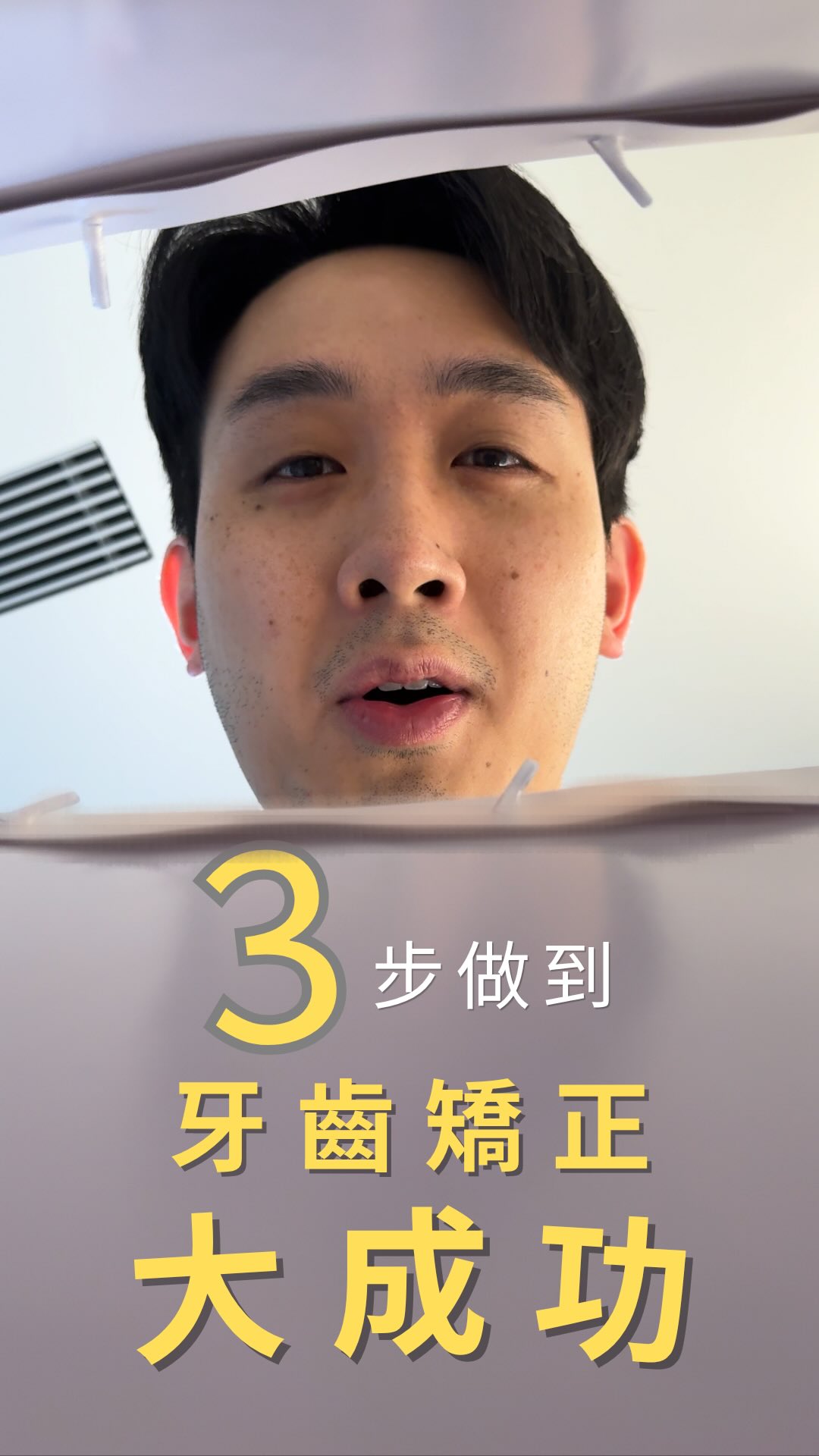 花大錢矯正,最怕走冤枉路!教你3步避開「矯正失敗」的陷阱😨
1️⃣ 挑選「指揮官」,設定正確目標🎯
2️⃣ 善用「AI 監控」,別盲目推進下一副📺
3️⃣ 把「維持器」當作療程延長賽🚴♂️
💡 碩醫師真心話: 矯正是一項精密的投資,美麗的關鍵在於「精準監控」與「醫病配合」。
未來,有備而來,讓你越來越美麗/帥氣😁🤩
想了解你的牙套到底有沒有貼合?歡迎留言或私訊聊聊!📩
#牙齒矯正
#隱形矯正
#精準醫療
#黃淳碩醫師
OrthoSoEasyDrAlbert
albertdentistdiary