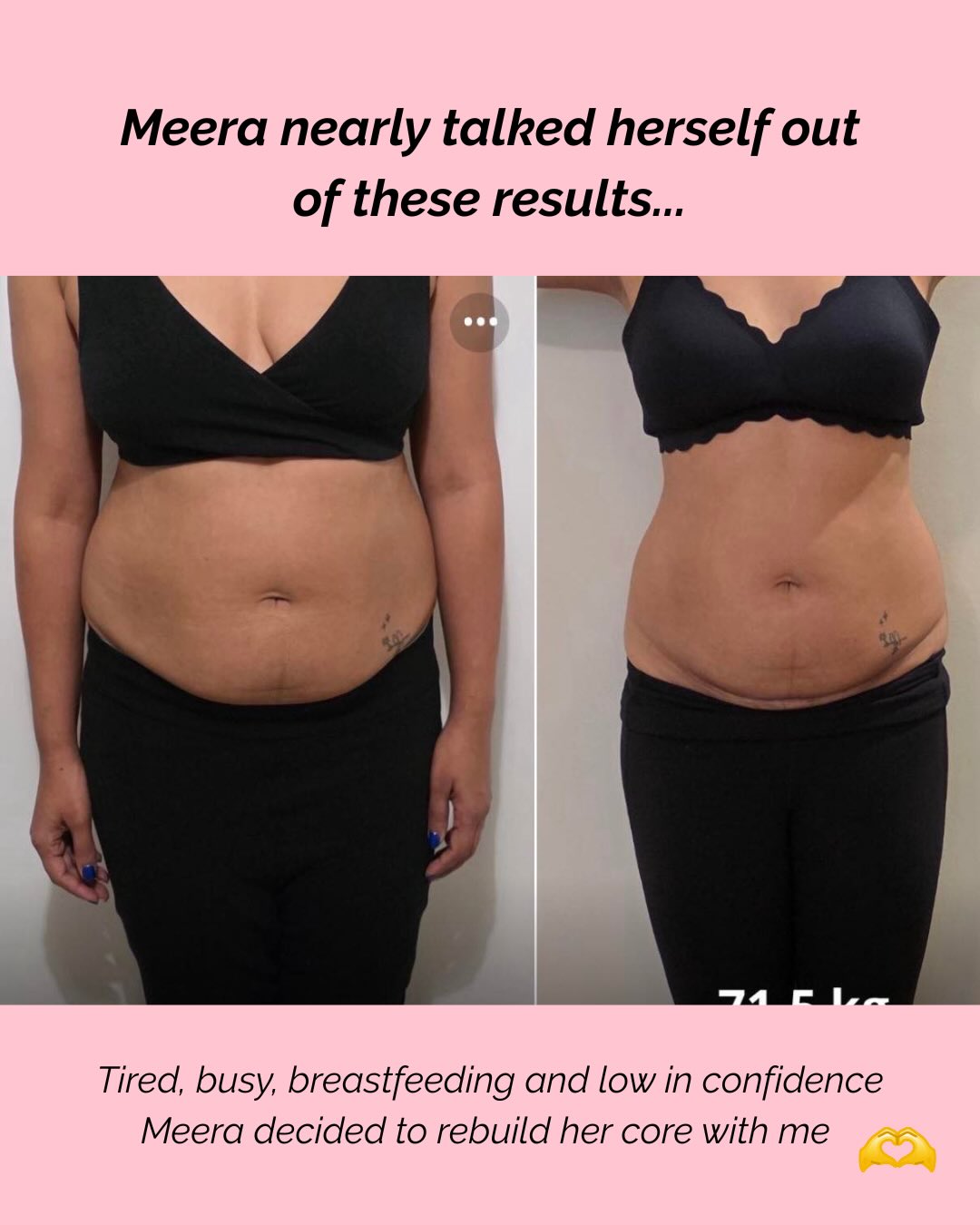 If you’ve ever looked in the mirror and thought ‘nothing will work for my tummy / core’... this is for you 👇
When Meera joined Core Builder, she wanted to feel more confident in her tummy after the birth of her little one 💕
It doesn’t matter WHEN you had your little ones, every woman should rebuild their core after birth. It’s not just a visual thing… because if you don’t, your body will never function or feel as good as it should.
One of the reasons you don’t, is partly because you don’t know it’s even a thing! But also because we are full of self doubt.
Meera gelt like giving up plenty of times.. she worries if she was engaging her core correctly; compared to others and felt she wasn’t doing enough and always doubted that she was even changing her body
But instead of giving up, she reached out, trusted the process and kept going. ❤️
Month by month, she learnt how to engage, activate and strengthen her core. She followed a balanced, realistic approach to food (while breastfeeding!) and focused on consistency, not perfection.
The result? A stronger core, a more toned body, a flatter tummy and a holiday she could truly enjoy feeling confident. ☀️
And here’s the thing...
You exercise 10 minutes a day, 5x a week and you learn a LOT from my exercise in that time…
*But the transformation wasn’t just built on workouts, it was built on support, accountability and reassurance.
Whether you’re months postpartum or years down the line, it’s never too late to rebuild your body with my Core Builder ❤️
Meera, you smashed it. 👏👑
#katesmumfitclub #corebuilder #motherhoodjourney #corestrengthening