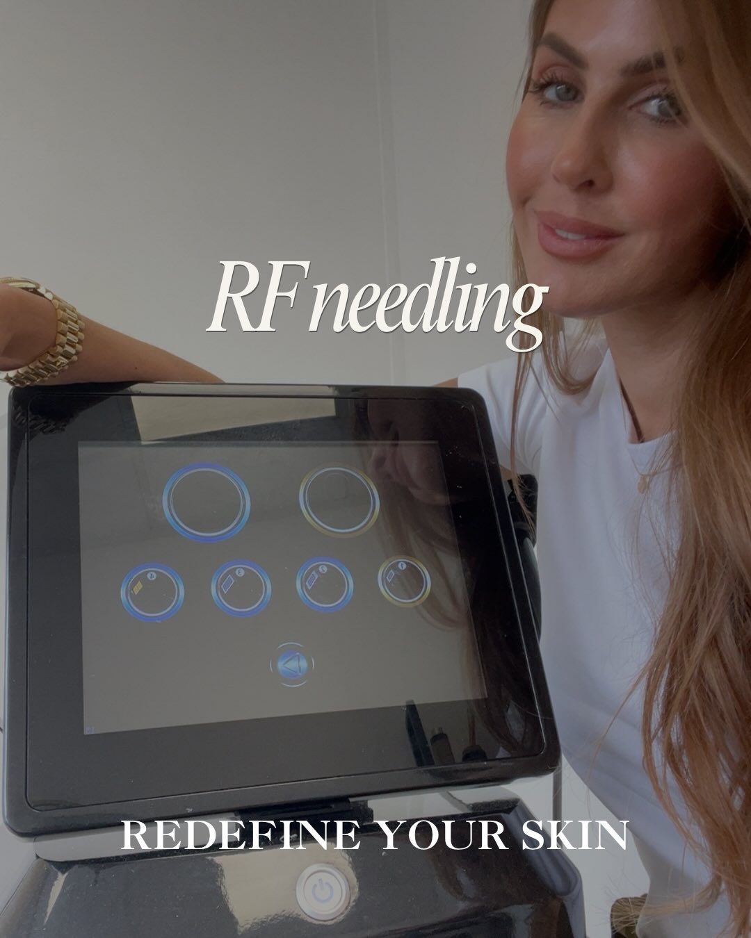 RF needling helps improve pores, acne scarring and skin texture while tightening the skin!
One of the best treatments for overall skin quality.
Texture, pores, acne scars, fine lines — RF needling treats multiple concerns at once, minimal recovery time with maximum results
Comment GLOW and we will send you a special offer!
R x