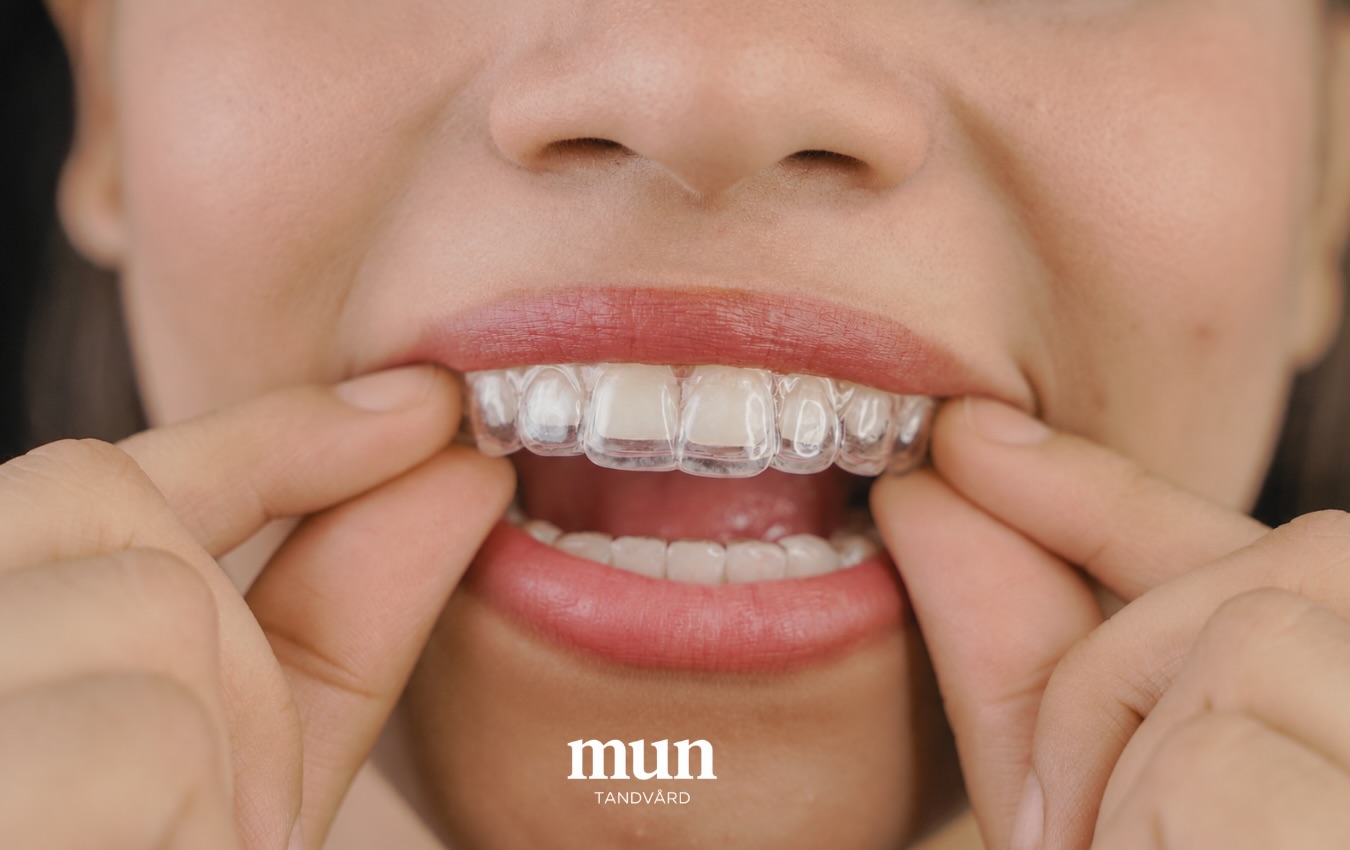 Rakare tänder. Större självförtroende.
Invisalign är ett diskret sätt att skapa ditt drömleende.