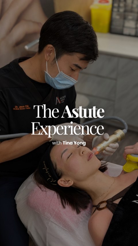 ✨ Come along with Tina as she spends a day at Astute Medical. ✨
From her consultation with Dr Jason to her personalised skin treatment, every step of the journey is tailored to her unique skin concerns and goals.
We believe great skin isn't about chasing trends — it's about understanding your skin and finding the right treatment plan for you. 💙
Whether you're dealing with acne, acne scars, pigmentation, dullness, or simply want healthier-looking skin, our doctors are here to guide you every step of the way.
📍 Astute Medical Clinic
📲 DM us or WhatsApp us to book your consultation.