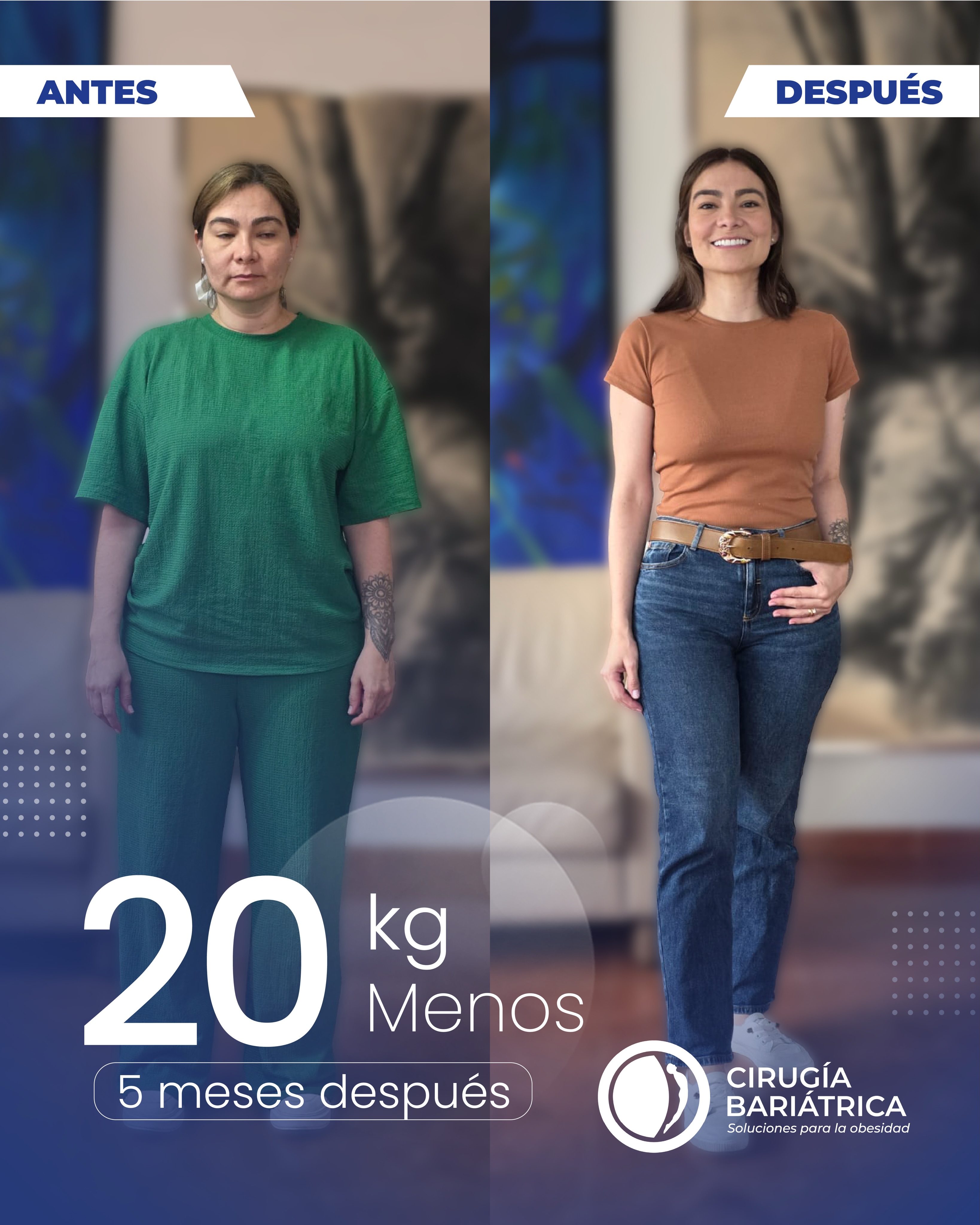 Resultados que hablan por sí solos: 20 kilos menos en solo 5 meses.👏✨
La cirugía bariátrica del Dr. Bolaños y su equipo está diseñada para lograr excelentes resultados y mejorar la calidad de vida de cada paciente, con tecnología, experiencia y compromiso.🌻
Contactos: +57 3155659167 | +57 3152887610 | Inglés o español ✅
#CirugíaBariátrica #Transformación #beauty