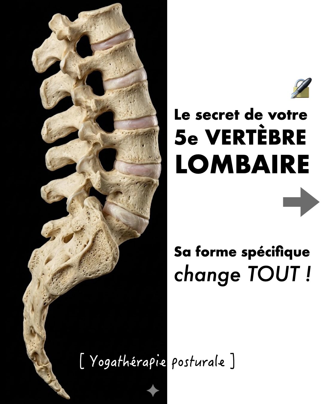 Le secret de la L5 : la vertèbre de la bipédie. 👣✨
S’il y a bien une pièce maîtresse dans l’incroyable ingénierie de notre corps, c’est elle.
La dernière vertèbre lombaire, la L5 est le pivot qui nous permet de nous ériger avec grâce face à la gravité.
Pour réussir cet exploit, la nature ne l’a pas faite droite, mais trapézoïdale.
Sa mission ?
Récupérer la pente naturelle de notre plateau sacré incliné afin de permettre à toute notre colonne de s’empiler en équilibre. C’est elle qui donne naissance à notre lordose lombaire basse, notre amortisseur originel.
Pourtant, une croyance tenace persiste : il faudrait « plaquer le bas du dos » ou « rétroverser » pour se protéger.
Mais la biomécanique nous montre une tout autre réalité. Effacer ce creux naturel réduit la surface d’appui de vos disques de 15 cm2 à seulement 5 cm2, faisant grimper la pression locale à plus de 52 kg/cm2 sans que vous ne le sachiez.
C’est ce qu’exprime l’ostéopathe Dominique Martin sous le terme d’illettrisme corporel : à force de vivre assis, notre boussole proprioceptive se perd et nous confondons parfois effort de redressement et aplomb naturel.
Pour vous aider à aller encore plus loin, à posséder enfin les clés de votre propre fonctionnement et à changer de dimension dans votre pratique, nous avons condensé des informations cruciales dans un dossier de référence (14 mn de lecture).
👇 Pour recevoir votre lien d’accès direct et gratuit en message privé, écrivez simplement le mot BASSIN en commentaire.
Exprimez-vous !
#Yogatherapie #Posturo #Aplomb #YogaAnatomie #Cathetsergeyoga