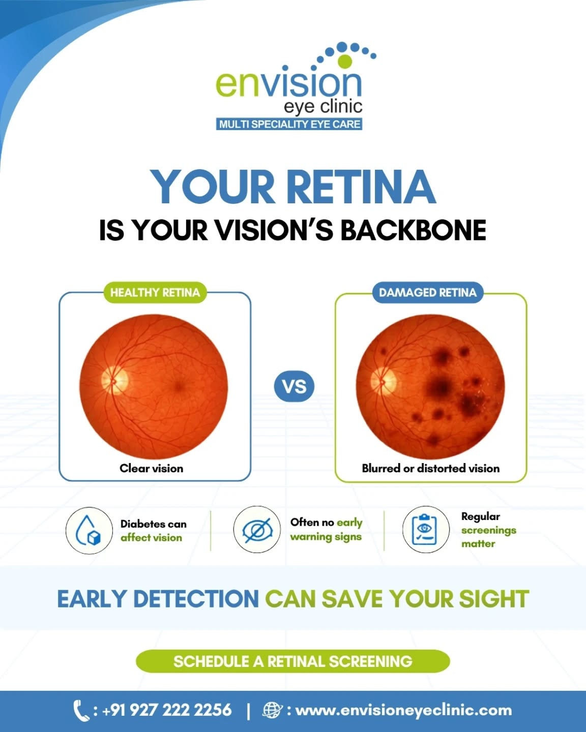 Your retina plays a vital role in preserving clear vision, yet many retinal conditions develop without noticeable symptoms. Regular retinal screenings can help detect problems early—especially for people with diabetes—and protect your sight before permanent damage occurs.
(retina health, diabetic eye disease, retinal screening, vision loss prevention, eye health awareness, early detection)
📍 2nd Floor, Shivraj Apartments, near Parihar Chowk, Aundh, Pune, Maharashtra 411007
#RetinaHealth #RetinalScreening #EyeHealth #VisionCare #EnvisionEyeClinic