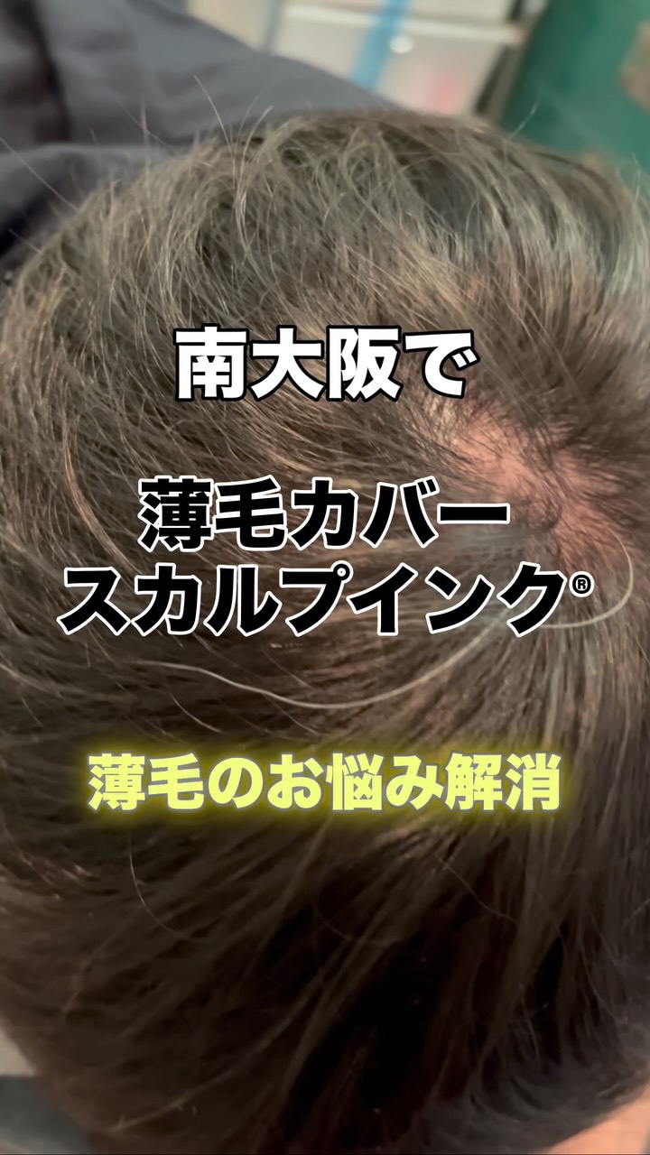 その薄毛、まずは“スカルプインク®“が自分に合うのか、から試しませんか?
当店では、皆様に安心して試していただけますように。初回施術で定着適性を見極め、万が一合わない場合は半額返金保証いたします。
無理に続けさせることはありません。結果に自信があるから、この仕組みです。
👉まずは“あなたに合うか”を確認してください。
【初回適正診断保証(半額返金)】
初回施術後、頭皮状態や色素の定着を確認し、当店基準で継続が難しいと判断した場合、初回施術費用の半額を返金いたします。
※以下の場合は対象外
・当店が継続可能と判断した場合
・お客様都合による中断など
・デザインの好みによる不満など
・アフターケア未実施など
──────────────────────
髪が薄くなると、見た目だけでなく気分まで沈みがち。
でも、もう一人で悩まなくて大丈夫です。
前髪・つむじ・分け目。
どこから見られても怖くない自然な仕上がりへ。
スカルプインク®は極小ドットで濃さを再現する
“最もバレにくい”頭皮タトゥー技術。
・痛みほぼなし/麻酔不要
・色落ちしにくい専用インク
・即日変化を実感/男女対応
産後脱毛・円形脱毛・傷跡にも対応。
──────────────────────
※美容師歴20数年の認定アーティストが責任を持って施術します。
※この地で開業18年となります、ご安心してお任せください。
大阪・和泉市|THREE BRANCHES
✨今なら3.3万発
49500円が33,000円(税込)
今なら何度でも‼️
📩公式LINEでご相談ください。
#スカルプインク
#薄毛対策
#南大阪
#つむじ
#頭皮タトゥー
※大阪で薄毛で悩まれている男性も女性も
ぜひ1度お声掛けください。