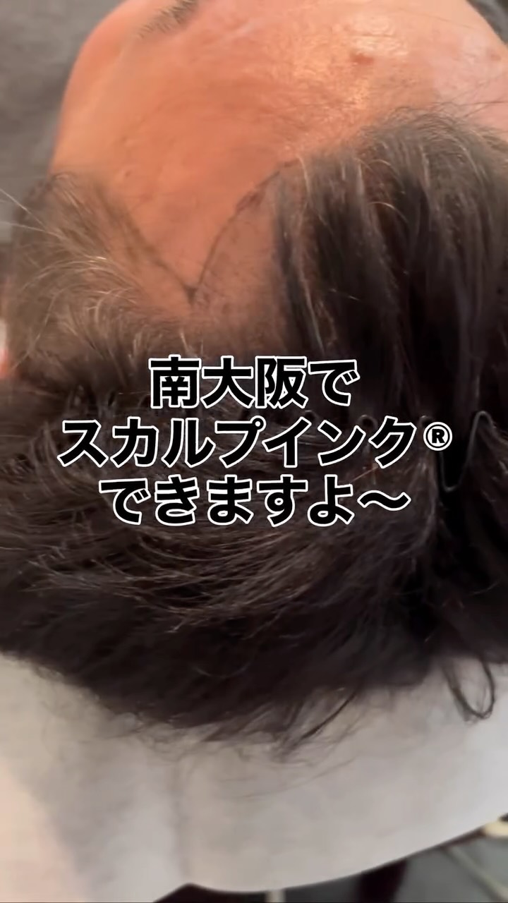その薄毛、まずは“スカルプインク®“が自分に合うのか、から試しませんか?
当店では、皆様に安心して試していただけますように。初回施術で定着適性を見極め、万が一合わない場合は半額返金保証いたします。
無理に続けさせることはありません。結果に自信があるから、この仕組みです。
👉まずは“あなたに合うか”を確認してください。
【初回適正診断保証(半額返金)】
初回施術後、頭皮状態や色素の定着を確認し、当店基準で継続が難しいと判断した場合、初回施術費用の半額を返金いたします。
※以下の場合は対象外
・当店が継続可能と判断した場合
・お客様都合による中断など
・デザインの好みによる不満など
・アフターケア未実施など
──────────────────────
髪が薄くなると、見た目だけでなく気分まで沈みがち。
でも、もう一人で悩まなくて大丈夫です。
前髪・つむじ・分け目。
どこから見られても怖くない自然な仕上がりへ。
スカルプインク®は極小ドットで濃さを再現する
“最もバレにくい”頭皮タトゥー技術。
・痛みほぼなし/麻酔不要
・色落ちしにくい専用インク
・即日変化を実感/男女対応
産後脱毛・円形脱毛・傷跡にも対応。
──────────────────────
※美容師歴20数年の認定アーティストが責任を持って施術します。
※この地で開業18年となります、ご安心してお任せください。
大阪・和泉市|THREE BRANCHES
✨今なら3.3万発
49500円が33,000円(税込)
今なら何度でも‼️
📩公式LINEでご相談ください。
#スカルプインク
#薄毛対策
#南大阪
#つむじ
#頭皮タトゥー
※大阪で薄毛で悩まれている男性も女性も
ぜひ1度お声掛けください。