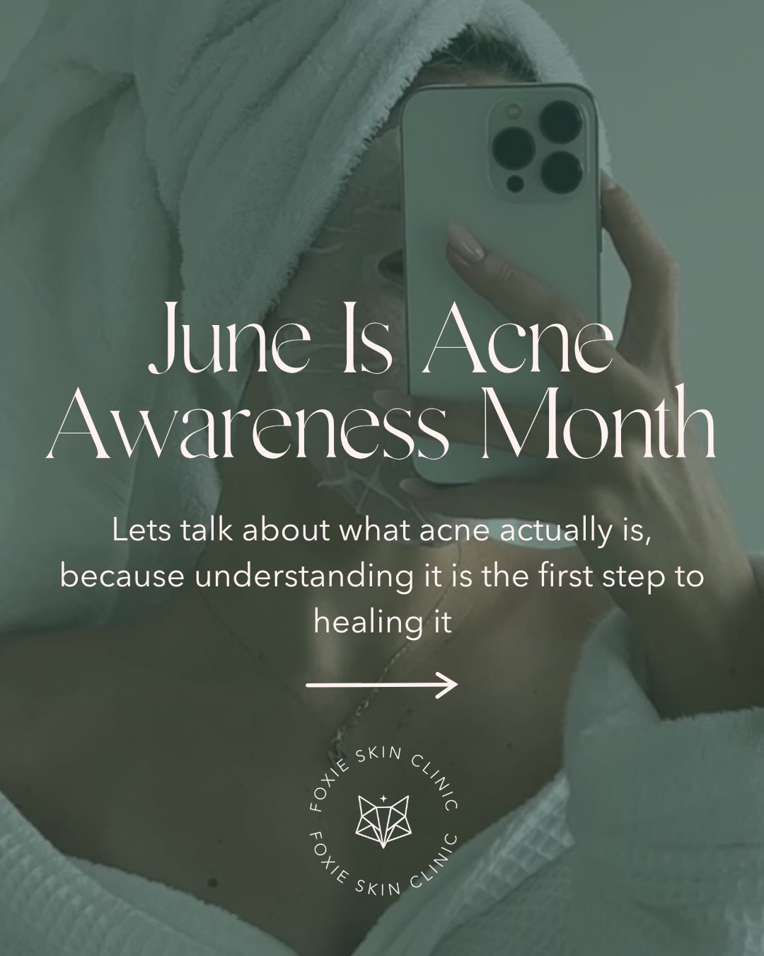June is Acne Awareness Month 🤍
And before we talk about how to clear acne, we need to understand what it actually is.
Acne isn’t just a “skin problem.”
It’s an inflammatory condition influenced by factors such as hormones, stress, diet, genetics, gut health, lifestyle and more.
That’s why so many people spend years trying products that never truly solve the problem.
Because if you don’t understand what’s driving your acne, you’re just guessing.
✨ Swipe through to learn more ✨
YOU DON’T NEED ANOTHER PRODUCT.
You need to understand why your acne is happening 🫶🏼
That’s exactly what The Acne Blueprint helps you do.
DM “BLUEPRINT” to find out more 🤍✨