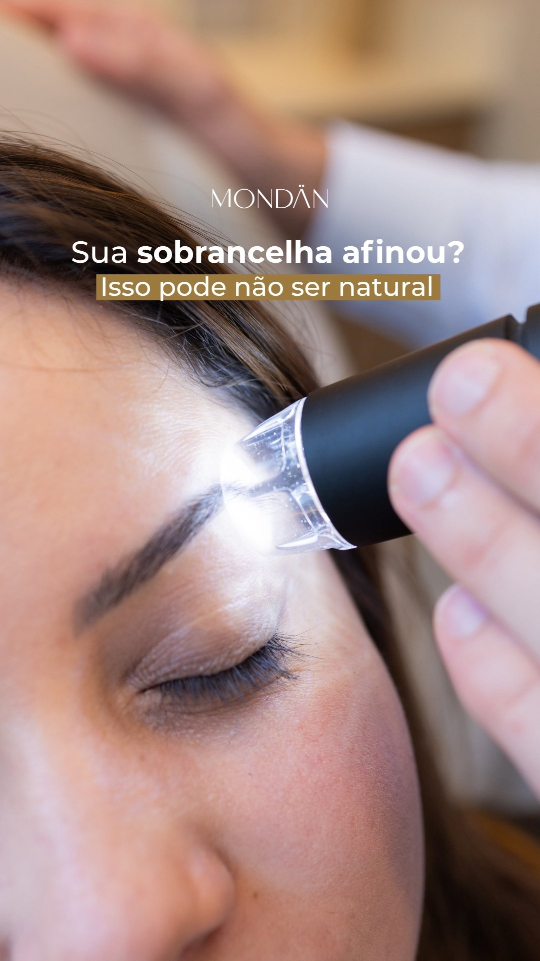 Muita gente acredita que sobrancelhas finas são apenas uma característica natural.
Mas, em alguns casos, falhas, afinamento ou dificuldade de crescimento podem indicar alterações hormonais, inflamações ou doenças de pele.
E, assim como acontece no cabelo, cada causa exige um tratamento diferente.
Na Mondän, avaliamos não apenas a estética, mas a saúde dos fios e da pele.
Se você percebe mudanças na sua sobrancelha, vale investigar.
Agende sua consulta.