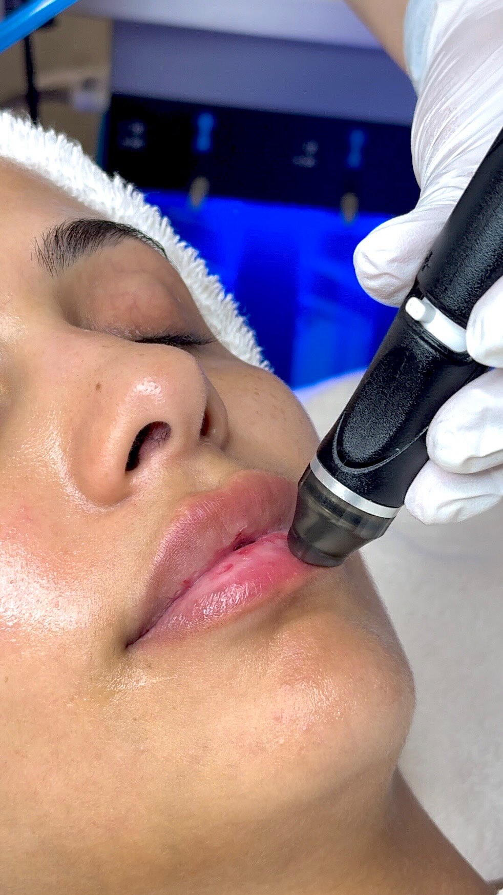 Meet Hydrafacial Perk 👄👁 hydration and refreshment for your lips & eyes in one treatment 💖
#HydrafacialPerk #HydrafacialQatar #BeautyBoxQatar #LipCareDoha #EyeCareQatar