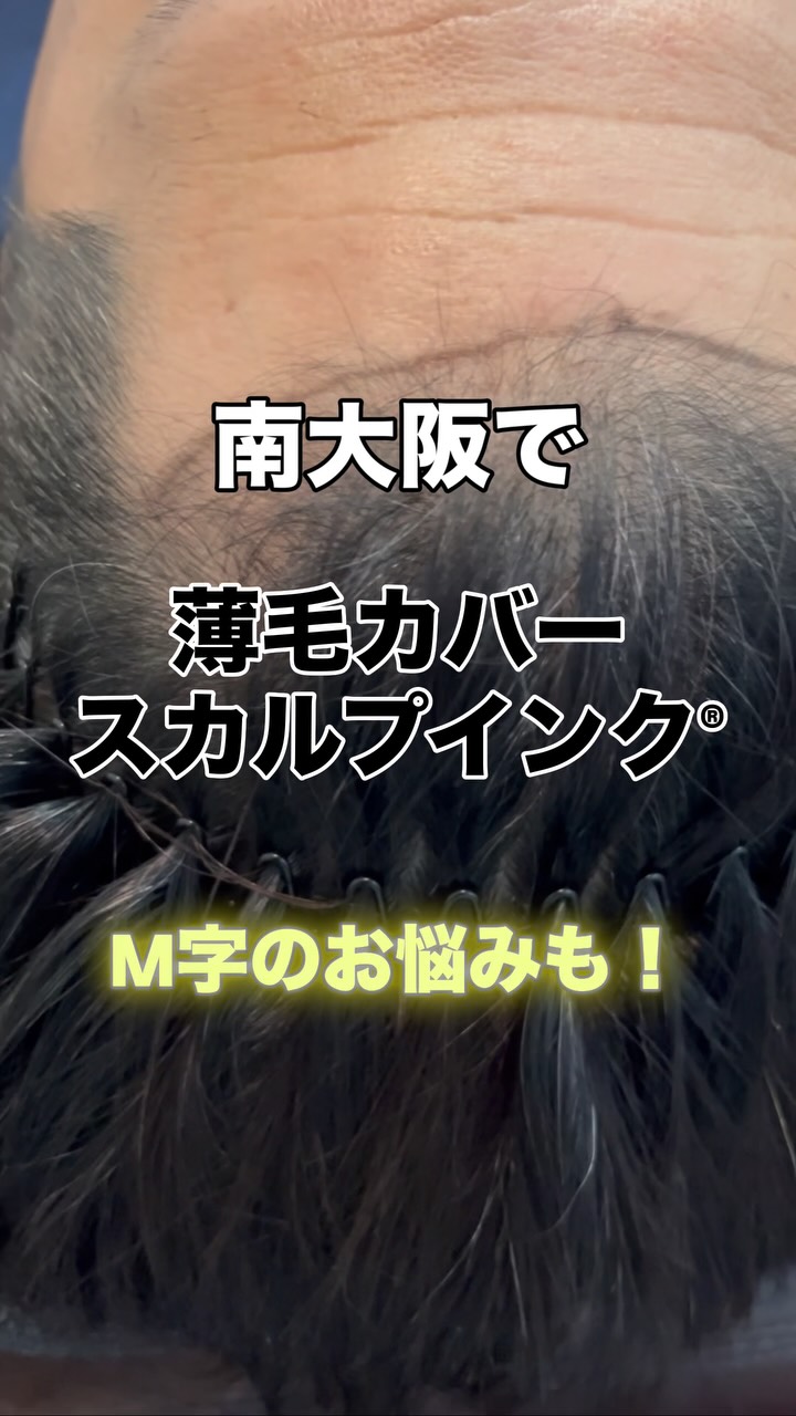 その薄毛、まずは“スカルプインク®“が自分に合うのか、から試しませんか?
当店では、皆様に安心して試していただけますように。初回施術で定着適性を見極め、万が一合わない場合は半額返金保証いたします。
無理に続けさせることはありません。結果に自信があるから、この仕組みです。
👉まずは“あなたに合うか”を確認してください。
【初回適正診断保証(半額返金)】
初回施術後、頭皮状態や色素の定着を確認し、当店基準で継続が難しいと判断した場合、初回施術費用の半額を返金いたします。
※以下の場合は対象外
・当店が継続可能と判断した場合
・お客様都合による中断など
・デザインの好みによる不満など
・アフターケア未実施など
──────────────────────
髪が薄くなると、見た目だけでなく気分まで沈みがち。
でも、もう一人で悩まなくて大丈夫です。
前髪・つむじ・分け目。
どこから見られても怖くない自然な仕上がりへ。
スカルプインク®は極小ドットで濃さを再現する
“最もバレにくい”頭皮タトゥー技術。
・痛みほぼなし/麻酔不要
・色落ちしにくい専用インク
・即日変化を実感/男女対応
産後脱毛・円形脱毛・傷跡にも対応。
──────────────────────
※美容師歴20数年の認定アーティストが責任を持って施術します。
※この地で開業18年となります、ご安心してお任せください。
大阪・和泉市|THREE BRANCHES
✨今なら3.3万発
49500円が33,000円(税込)
今なら何度でも‼️
📩公式LINEでご相談ください。
#スカルプインク
#薄毛対策
#南大阪
#つむじ
#頭皮タトゥー
※大阪で薄毛で悩まれている男性も女性も
ぜひ1度お声掛けください。