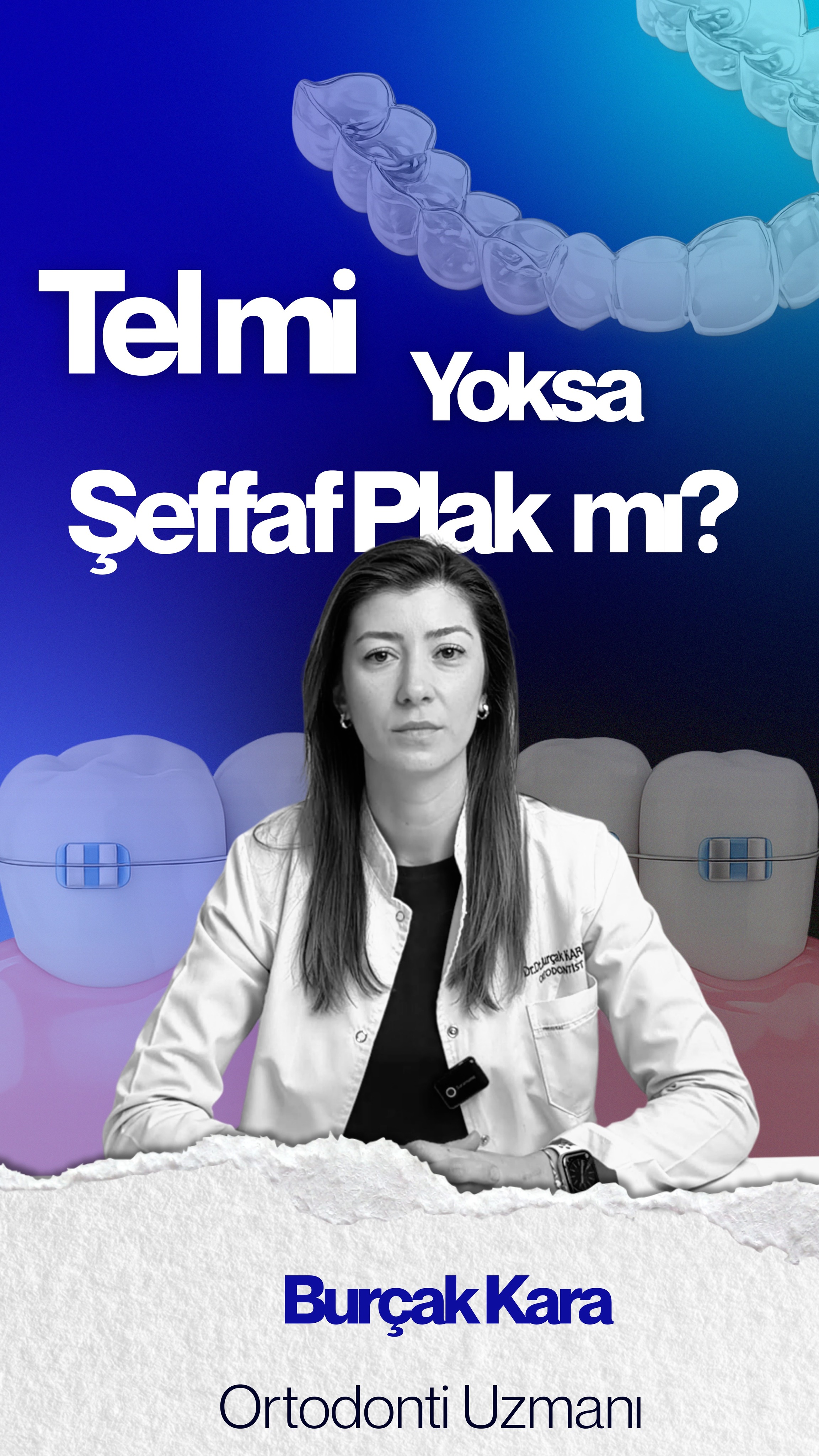 🦷 Tel mi Şeffaf Plak mı?
Ortodontik tedavide hangi yöntemin sizin için daha uygun olduğu; diş yapınıza, çene kapanışınıza ve tedavi ihtiyaçlarınıza göre değişebilir.
Metal braketler, seramik braketler ve şeffaf plak sistemleri farklı avantajlar sunabilir. Tedavi planlaması kişiye özel değerlendirilmelidir.
Videomuzda;
• Şeffaf plak ve tel tedavisi arasındaki temel farkları
• Günlük yaşam konforunu
• Tedavi süreçlerini
• Hangi durumlarda hangi yöntemin tercih edilebildiğini anlatıyoruz.
Detaylı değerlendirme ve ortodontik muayene için bizimle iletişime geçebilirsiniz.
📍 Burçak Kara Ortodonti
📍 Kayaşehir Ağız ve Diş Sağlığı Polikliniği
🦷 Braces or Clear Aligners?
The most suitable orthodontic treatment depends on your dental structure, bite alignment, and individual treatment needs.
Metal braces, ceramic braces, and clear aligner systems may each offer different advantages depending on the case. Treatment planning should always be personalized after a professional evaluation.
In this video, we explain:
• The main differences between braces and clear aligners
• Daily comfort and usability
• Treatment processes
• Which option may be preferred in different situations
For a detailed orthodontic evaluation, feel free to contact us.
📍 Burçak Kara Orthodontics
📍 Kayaşehir Oral and Dental Health Polyclinic