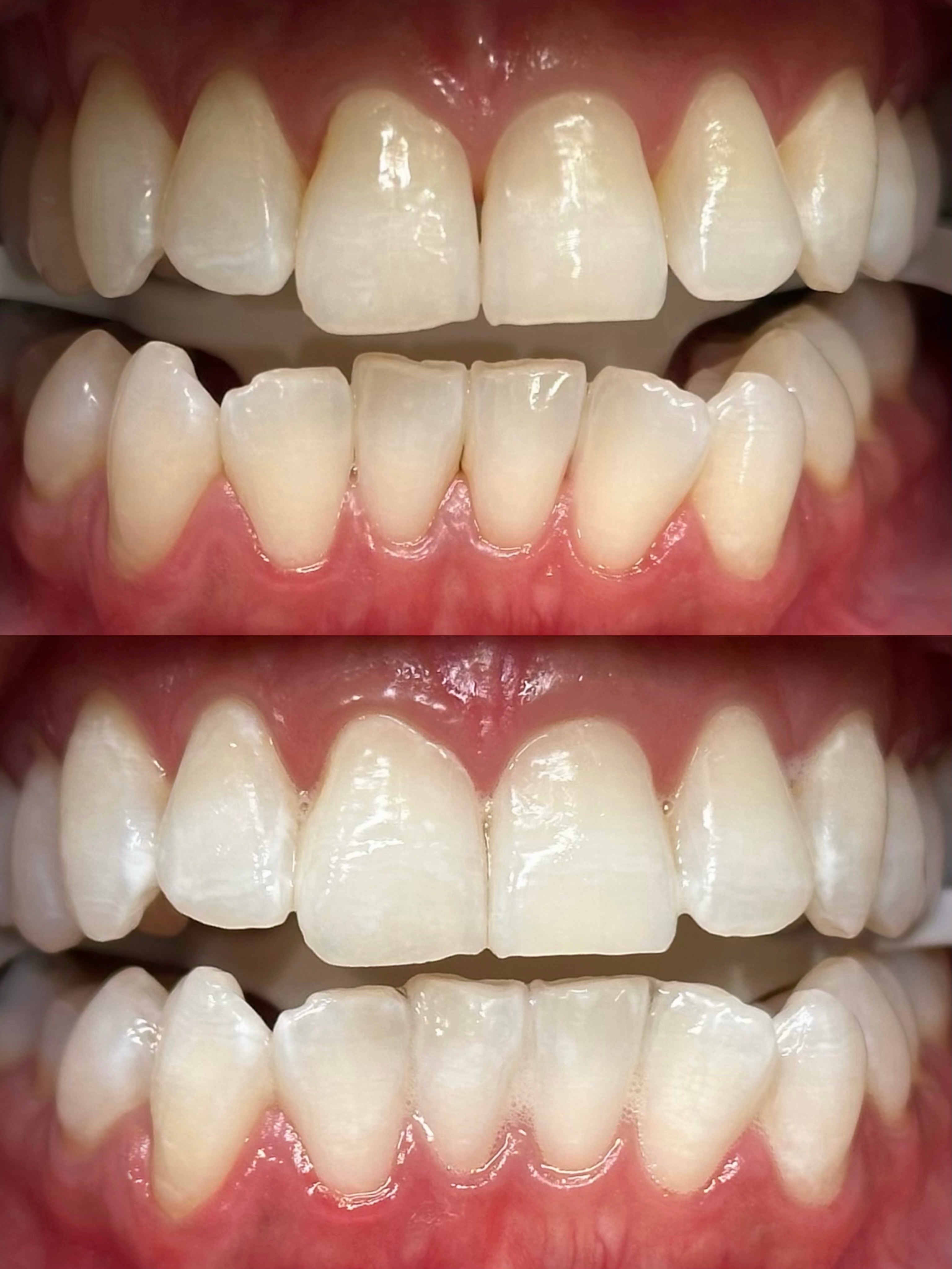 The prettiest finishing touch to a bright smile 💗
Simple. Feminine. Timeless.
#toothgems #teethwhitening #toothgemsnearme #napervilleil #luxthesmile