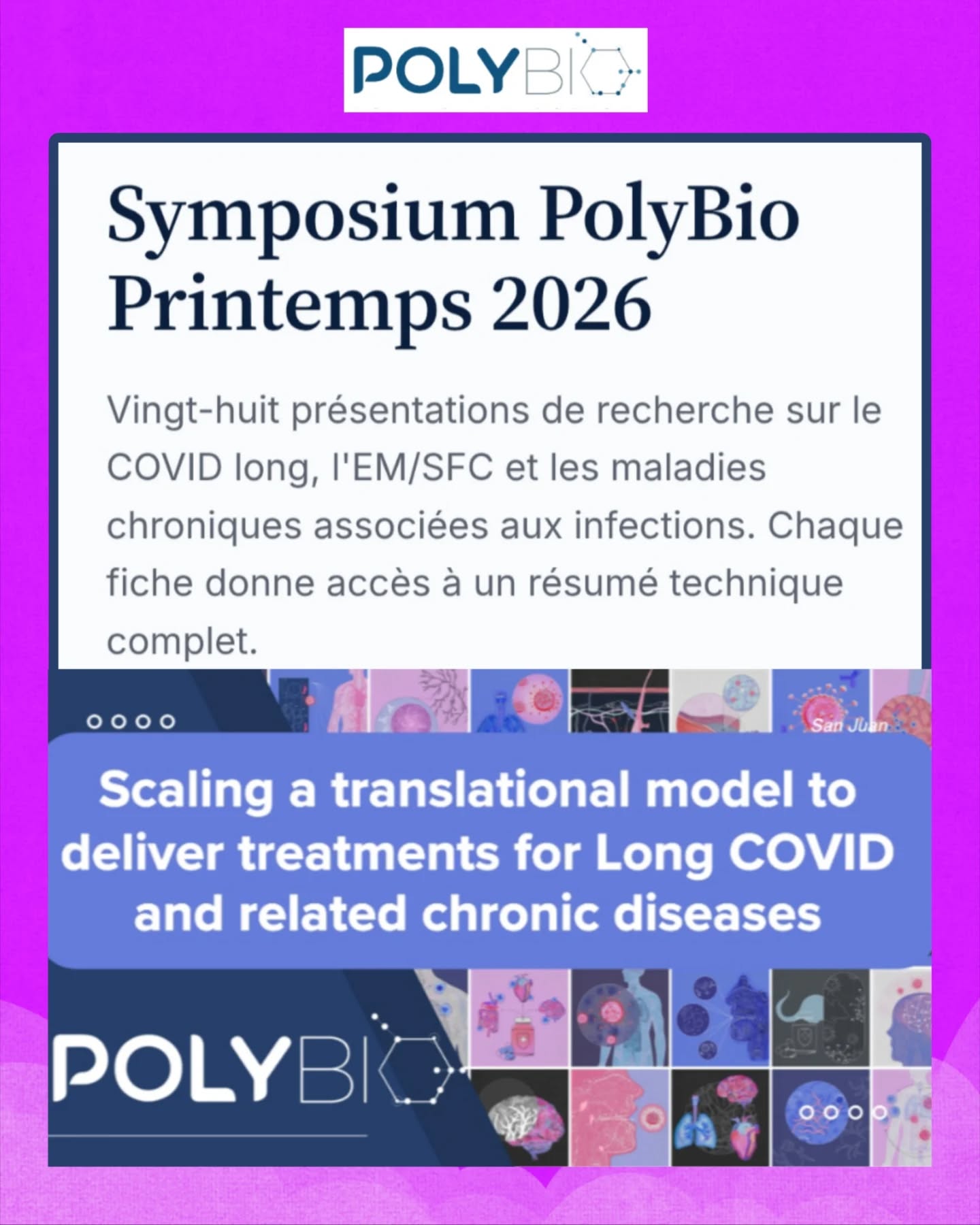 🧵🧬 Le Spring Symposium 2026 de @polybio.rf vient de se tenir en ligne : pendant 6h, une trentaine de présentation ayant un objectif central👉faire avancer biomarqueurs et traitements dans le #CovidLong et les maladies post-infectieuses.
🧠🧩Message clé d’ouverture d’Amy Proal : le Long COVID serait avant tout une maladie “tissulaire”.
👉 Autrement dit : les anomalies seraient surtout visibles dans les tissus (et pas forcément dans le sang), ce qui expliquerait une partie des diagnostics normaux… et des errances médicales.
🩸🔬Conséquence directe : énorme accélération des recherches sur les biomarqueurs.
🎯Objectif : sortir du flou clinique et identifier des signatures biologiques mesurables pour :
- stratifier les patients
- suivre l’évolution
- tester des traitements
🧪🏥 Projet phare : VIPER (UCSF + PolyBio)
➡️ 150 participants (Long COVID + contrôles)
➡️ biobanque multi-tissus (sang, salive, selles, tissus)
➡️ comparaison directe de plusieurs biomarqueurs concurrents dans une même cohorte
📊⚖️ Point crucial souligné par les chercheurs : aujourd’hui, les biomarqueurs sont testés en silos.
VIPER veut changer ça :
- mêmes patients
- mêmes conditions
- tests comparés en aveugle
👉 objectif : identifier 1 biomarqueur robuste (ou plus)
🧫 🔎Plusieurs pistes biomarqueurs présentées :
- Vésicules extracellulaires (Lyme & SARS-CoV-2 persistant)
- Détection T cells spécifiques (EBV, COVID…)
- Tests MENSA (mémoire immunitaire)
- Microfluidique pour détecter particules virales
👉 convergence vers la notion de persistance infectieuse
🦠🧬 Exemple important : recherche sur la persistance du SARS-CoV-2
Certaines équipes cherchent à :
- Détecter des traces virales dans le sang
- Identifier des réservoirs tissulaires
- Comprendre si le virus peut rester intact chez certains patients
🧠🧾Autre axe majeur : les lymphocytes T
Des équipes montrent que certaines cellules T restent “programmées” contre :
- SARS-CoV-2
- EBV
- autres herpesvirus
👉 hypothèse : réactivation virale + dérèglement immunitaire chronique
⏬Suite en commentaire⏬
🔗Liens en story puis en Story à la une