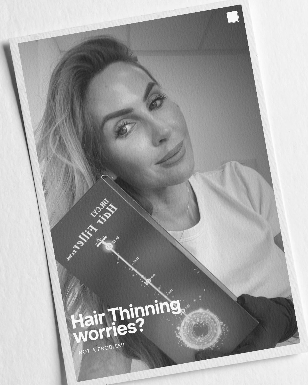 TRIGGER WARNING - NEEDLES
Hair thinning…?
Struggling with thinning hair, excessive shedding, or lack of volume?
Introducing Dr CYJ Hair Filler – an advanced treatment designed to nourish the scalp, strengthen hair follicles, and stimulate healthier, thicker-looking hair growth.
Using a powerful combination of peptides and hyaluronic acid, this innovative treatment helps to:
Reduce hair loss
Improve hair density
Strengthen weakened follicles
Enhance scalp health
Promote fuller, healthier hair
Suitable for both men and women experiencing hair thinning or hair loss.
Ready to restore your confidence and give your hair the boost it deserves..? Use the link in Bio to Book NOW
R x