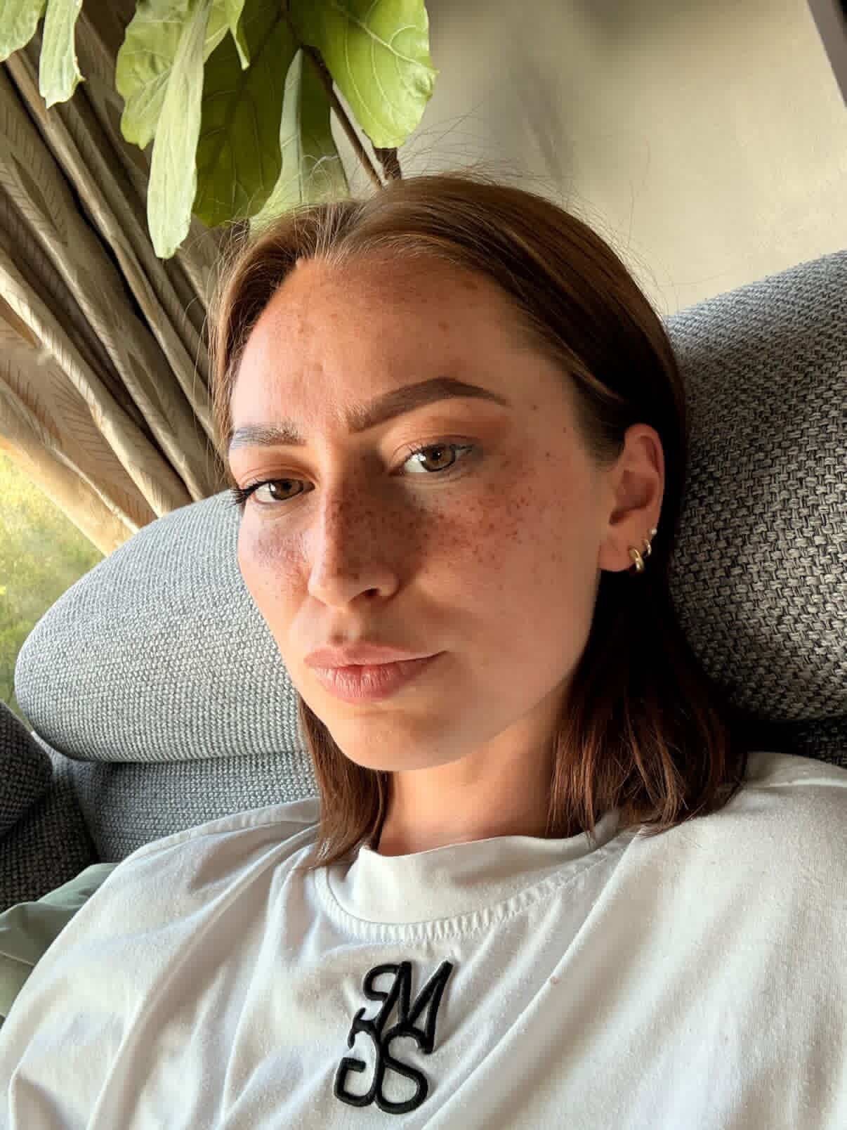 Trust the process ✨ loveee the freckiesss on Amy 🔥
Foto 1: Genezen sproetjes na 10 dagen
Foto 3: Sproetjes na 24 uur
Foto 4: Volledig gesetteld in de huid ✨
Nog even snel het volgende:
‘’ Wat bedoel ik met het settelen van de sproetjes in de huid?’’ - Op deze foto’s kun je duidelijk zien dat de sproetjes na de genezing (foto 1) heel goed zichtbaar zijn. ‘De ene lovessss it - de andere kan niet wachten totdat ze zachter zijn geworden.’
En dan? - De pigmenten gaan landen in de huid. Eigenlijk net zoals bij een echte tattoo. Eerst is de tattoo haarscherp, maar daarna zie je het design verzachten in de huid. Dat gebeurt ook bij jouw sproetjes. Uiteindelijk zie je zelfs dat er een groot gedeelte van je sproetjes optisch helemaal niet meer zichtbaar is….
Dan is het tijd voor een touch-up!
Een touch-up is altijd een extra service: bepaal zelf of je nog meer kleur, diepte of extra sproetjes wilt toevoegen.
En hoe bepaal je de juiste timing? - Hoe sneller je een touch-up boekt, hoe donkerder het eindresultaat. Hoe langer je de touch-up uitstelt, hoe zachter de eerste laag sproetjes wordt. Ben je meteen al happy met je eindresultaat? Dan stel je een touch-up zo lang mogelijk uit. Jij bepaalt 🔥
#freckles #sproetjes #tattoo #pmuart